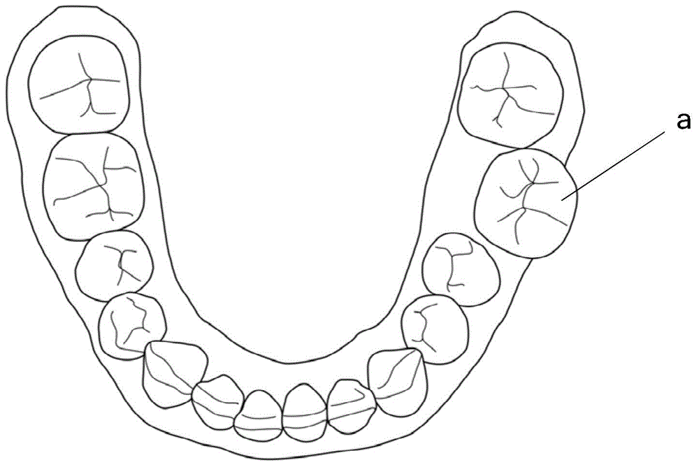 Method and system for producing dental brace