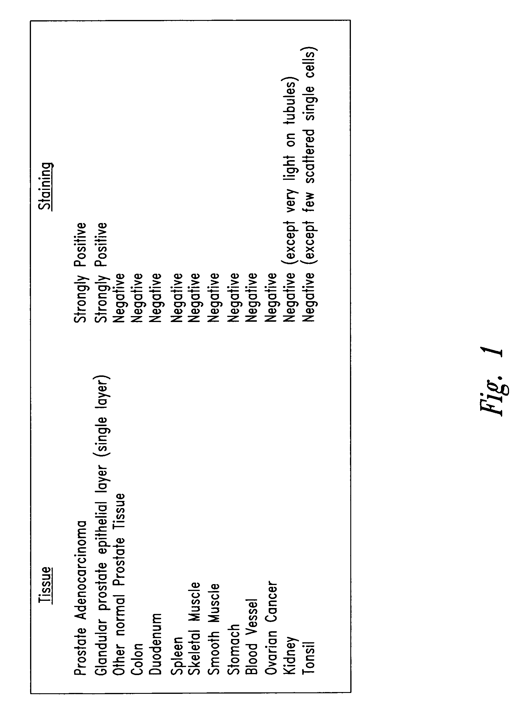 Detection and treatment of prostate cancer