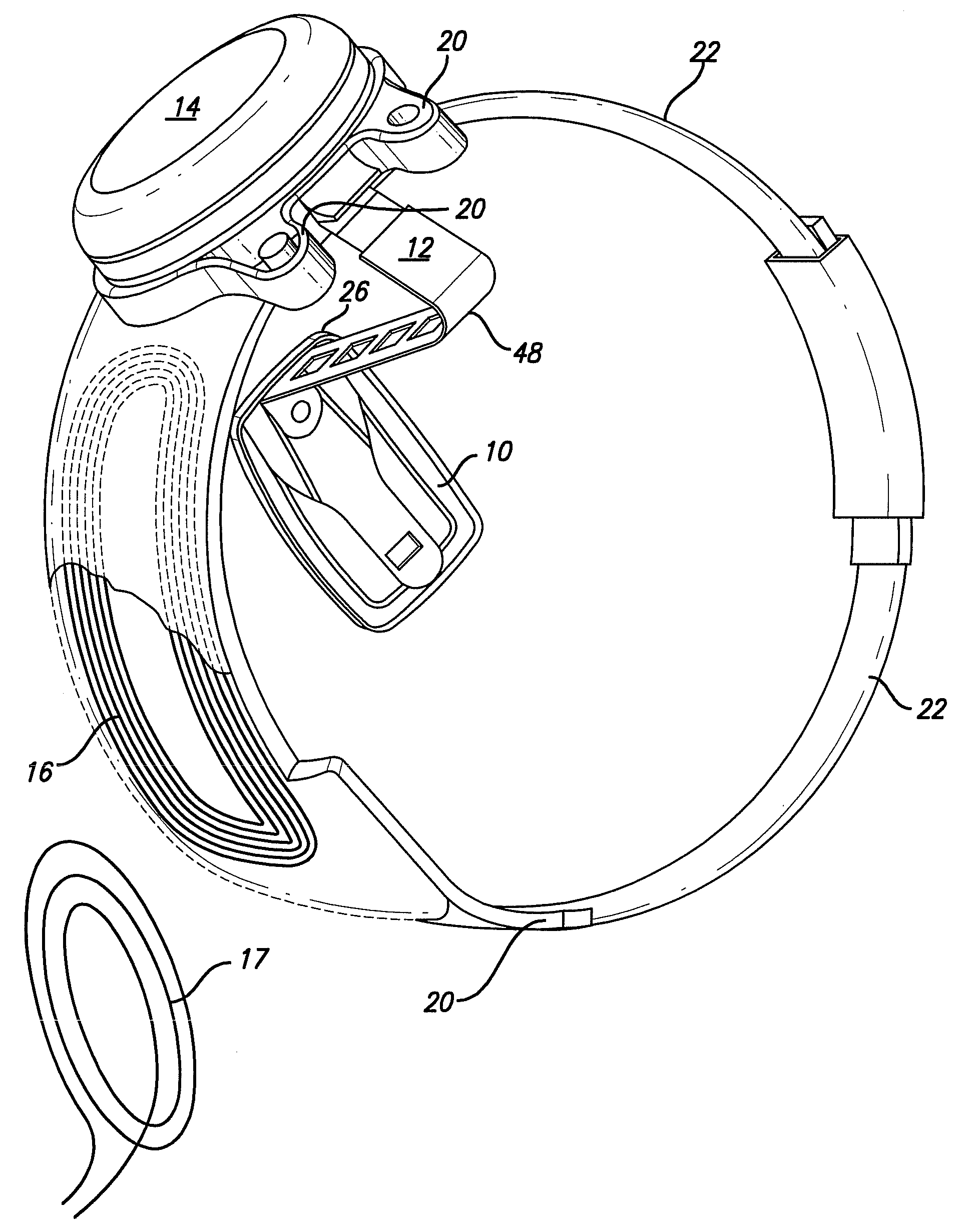 Visual prosthesis for phosphene shape control