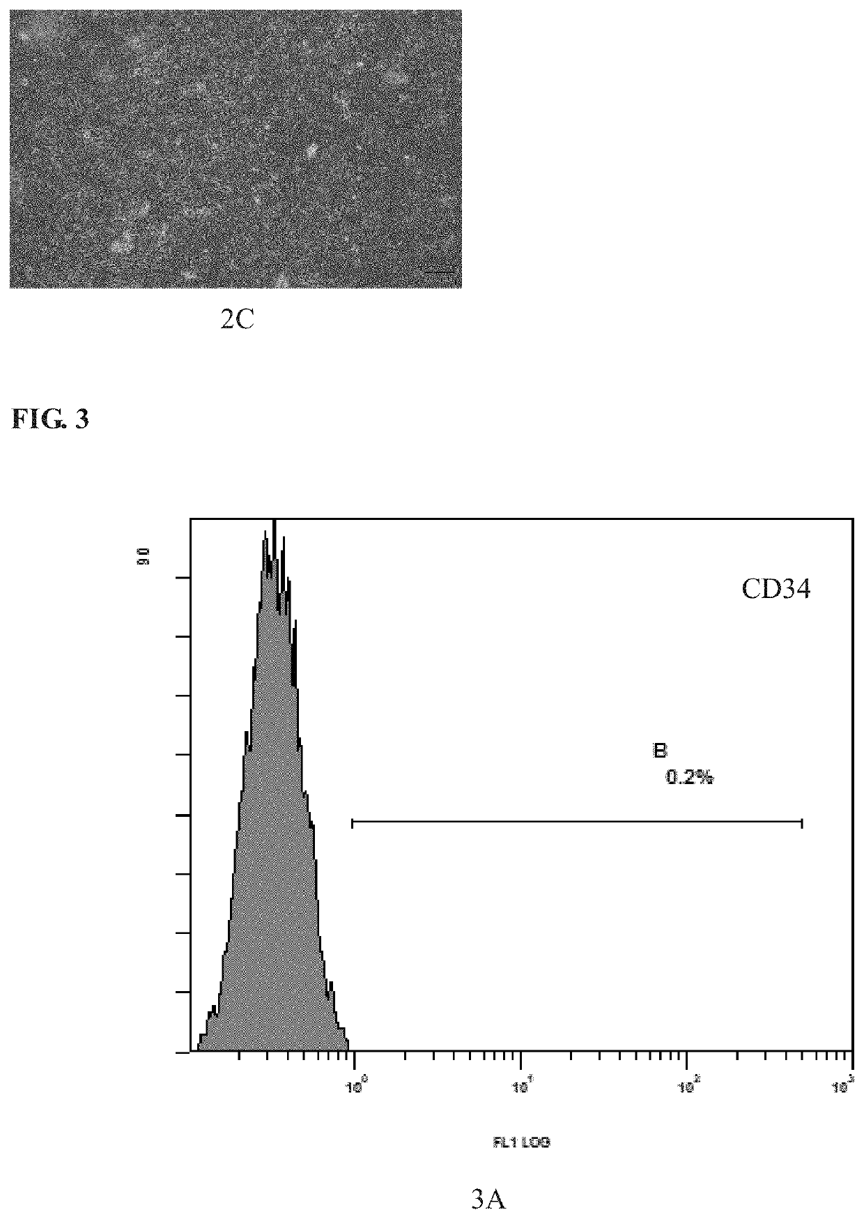 Method for separating and culturing mesenchymal stem cells from wharton's jelly tissue of umbilical cord
