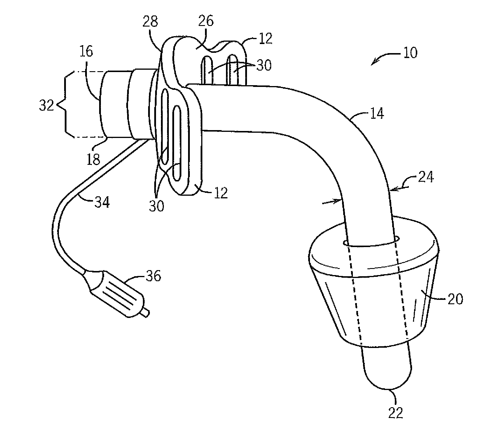 Tracheal tube with customizable flanges