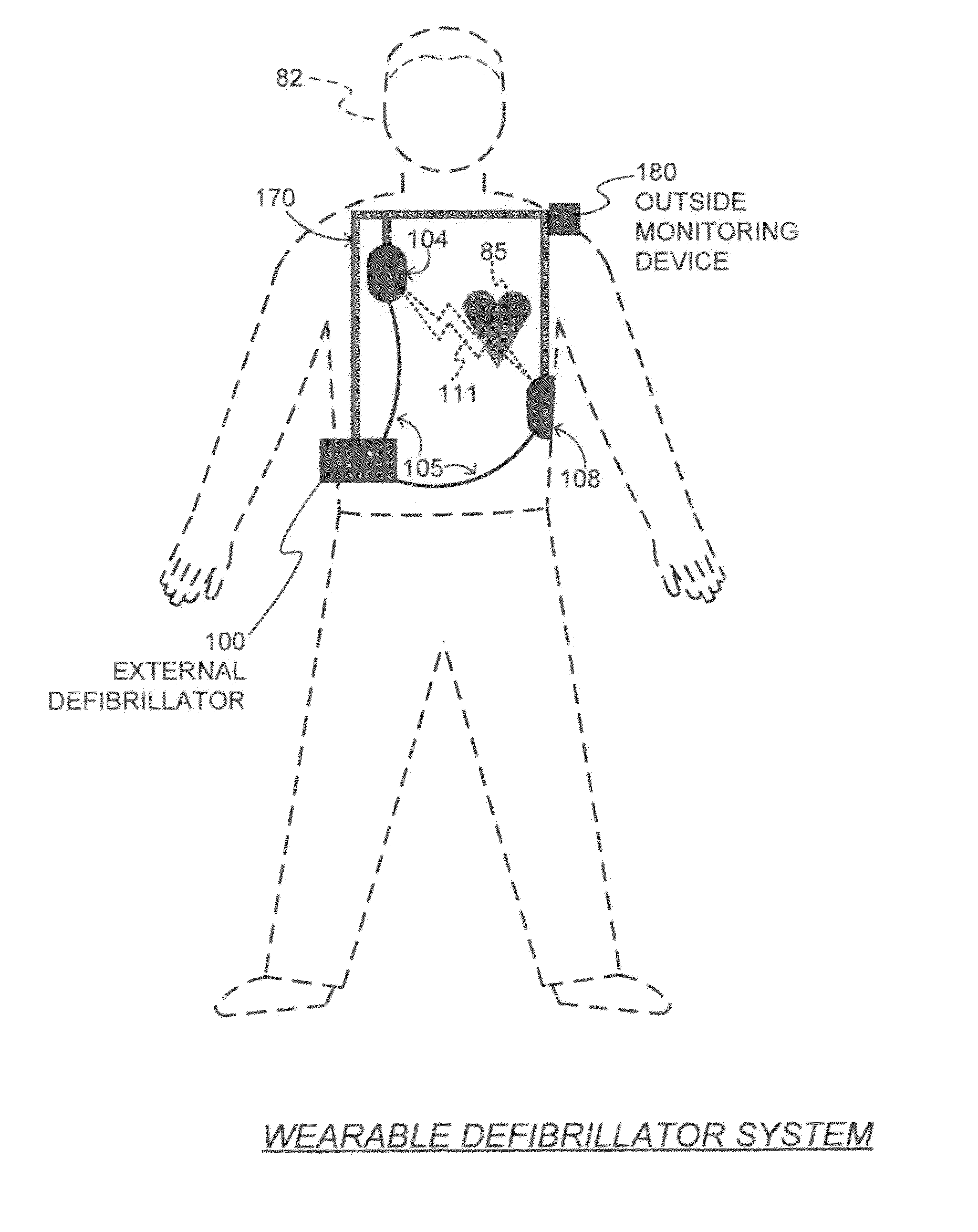 Wearable cardiac defibrillator system with anti-bradyarrhythmia pacing and methods