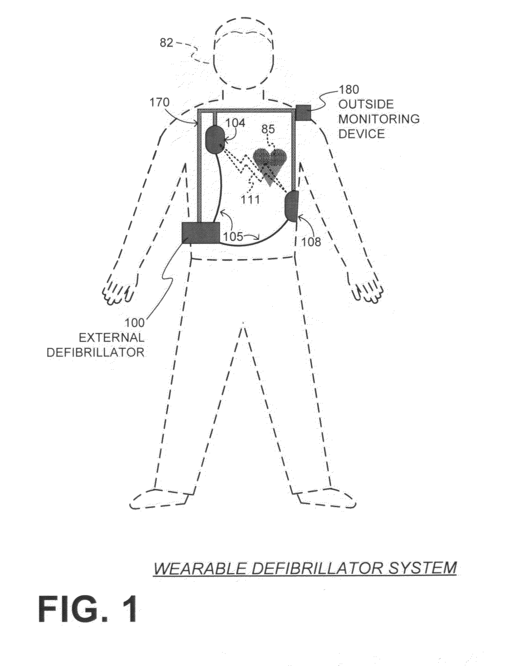 Wearable cardiac defibrillator system with anti-bradyarrhythmia pacing and methods