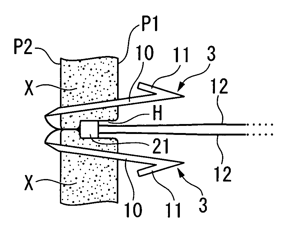 Perforation suture clip and clip device