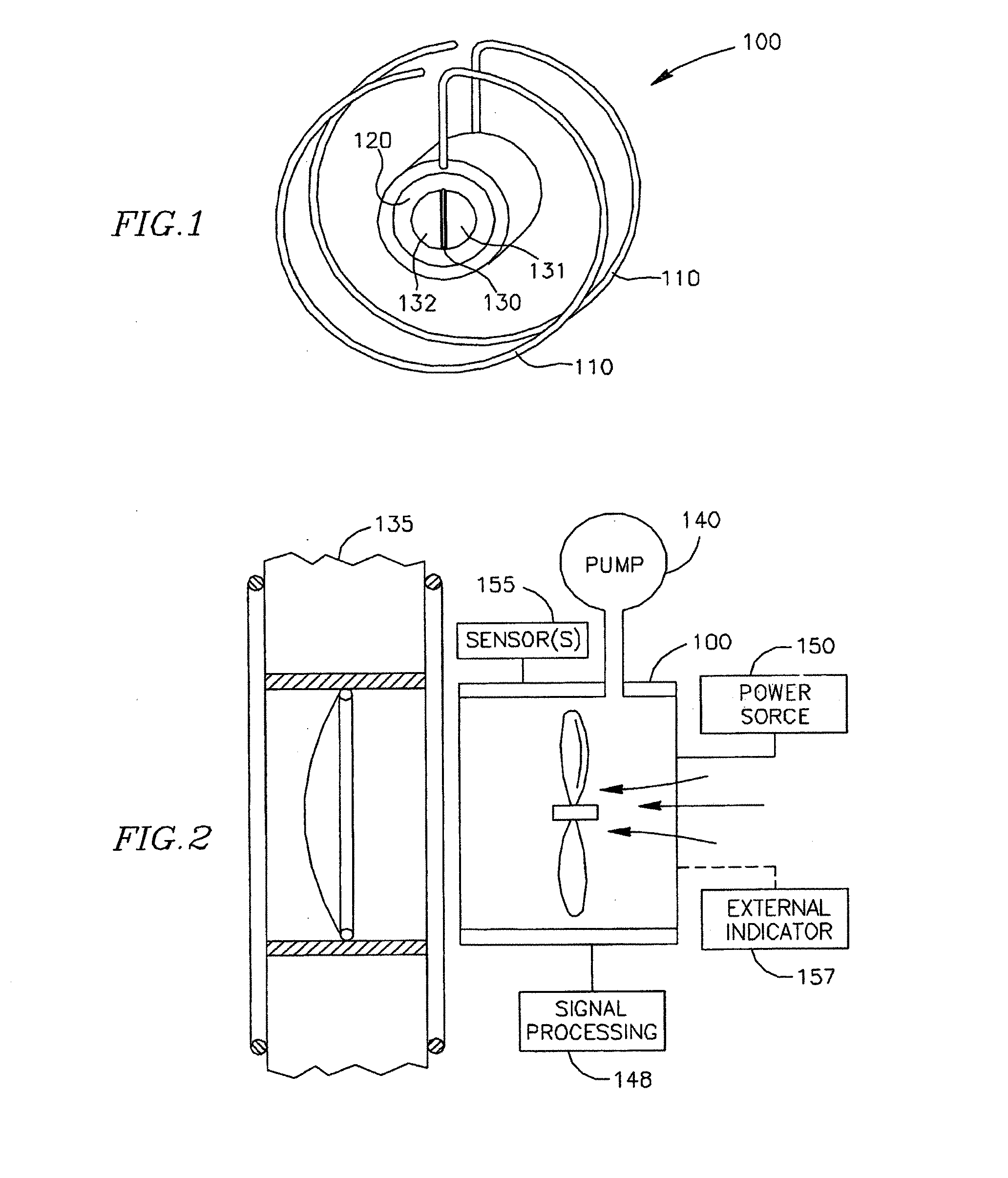 Methods and apparatus for reducing localized circulatory system pressure
