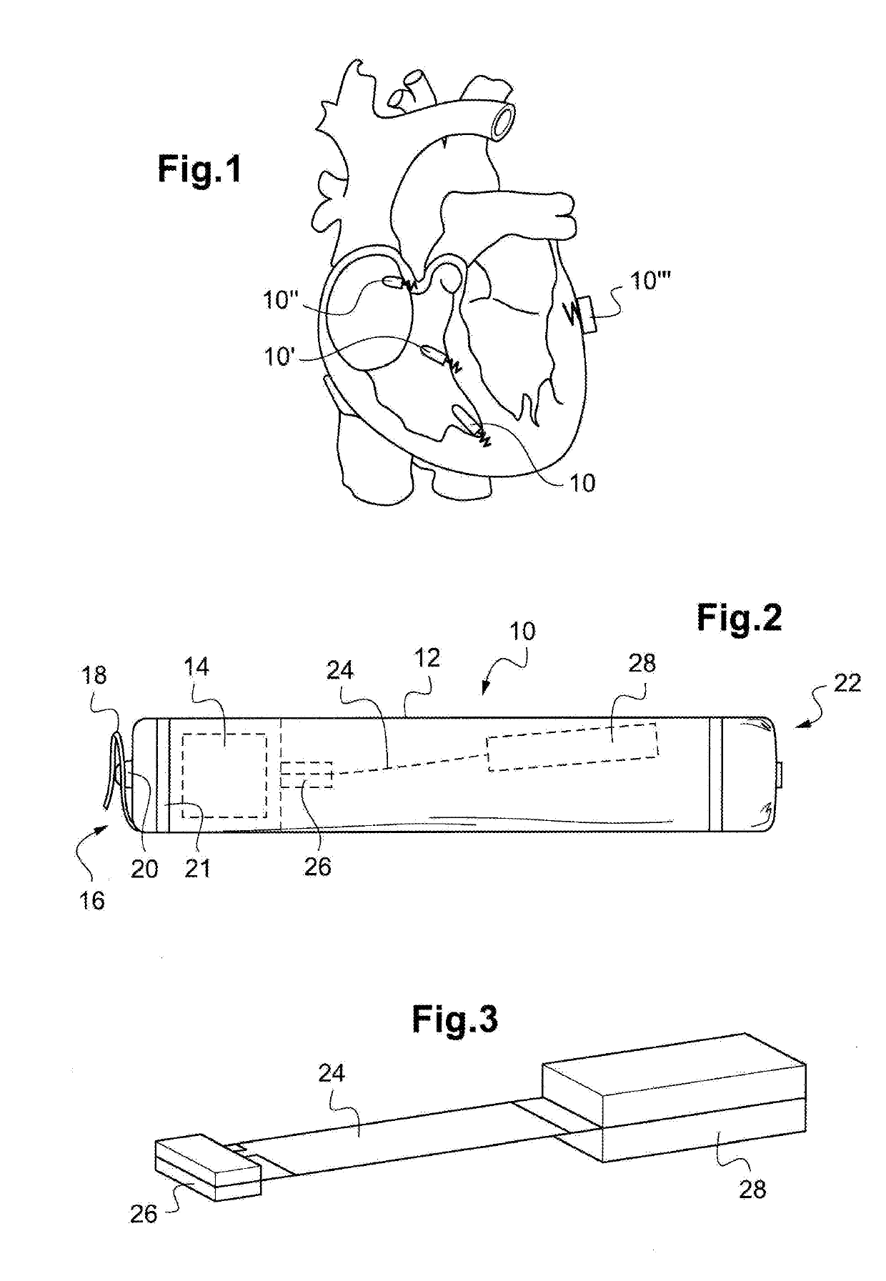Autonomous cardiac implant of the leadless capsule type with energy harvester and controlled-charge energy storage buffer