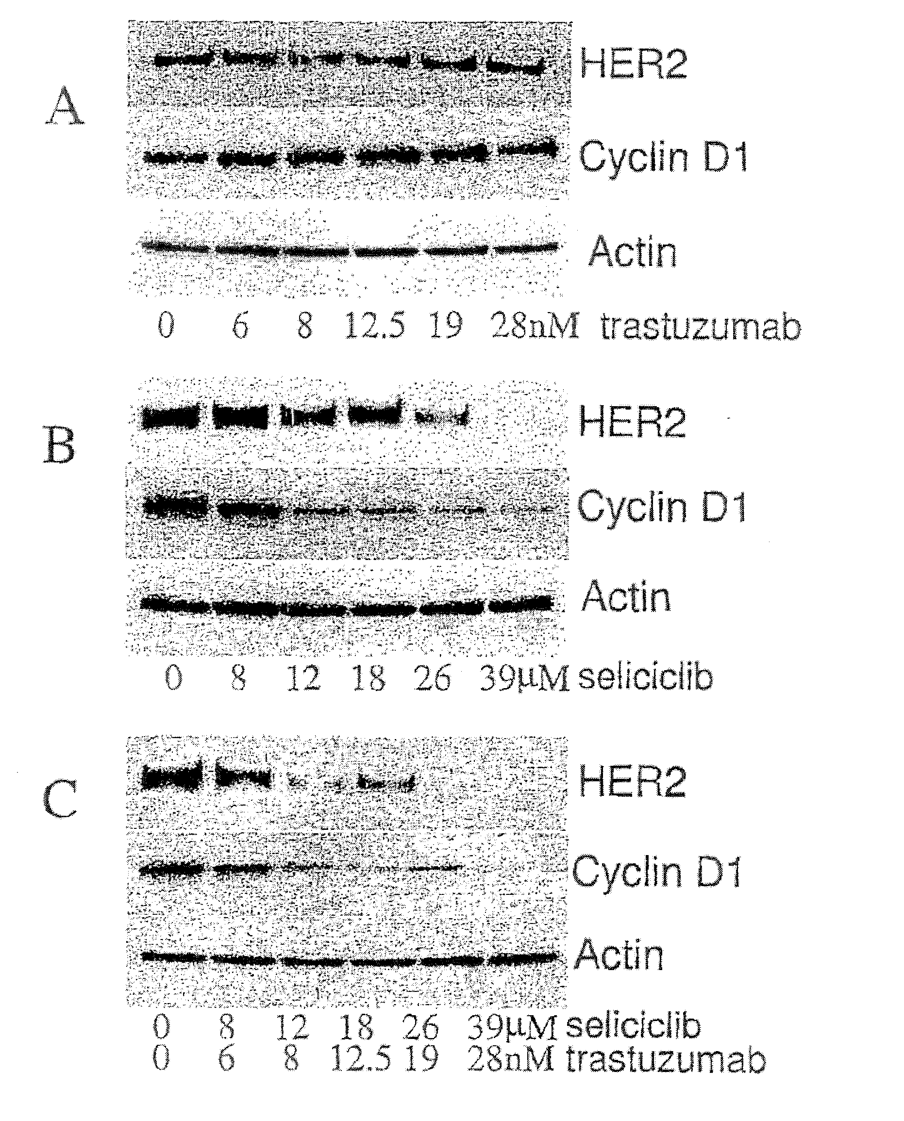 Combination of a purine-based cdk inhibitor with a tyrosine kinase inhibitor and use thereof in the treatment of proliferative disorders