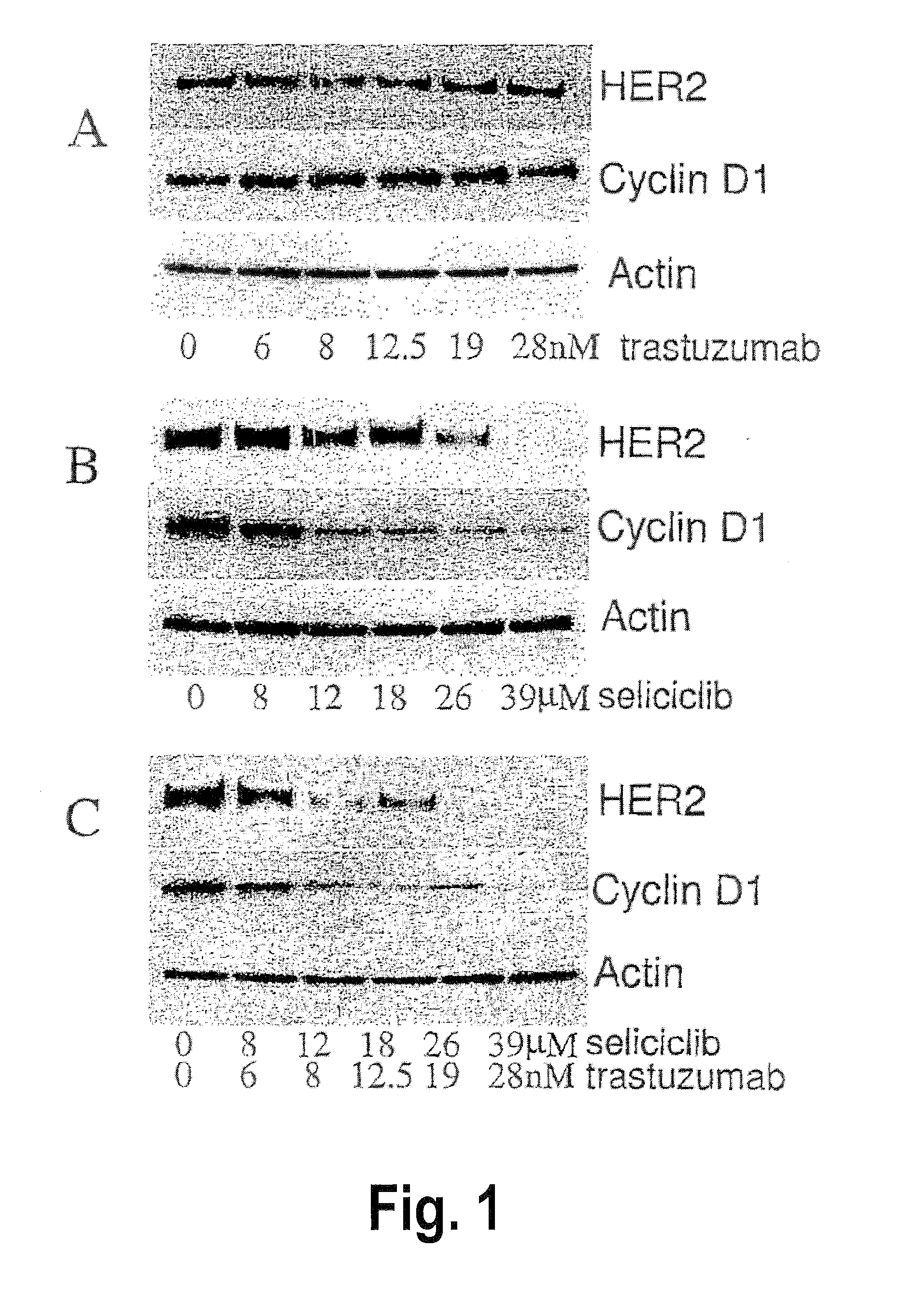 Combination of a purine-based cdk inhibitor with a tyrosine kinase inhibitor and use thereof in the treatment of proliferative disorders