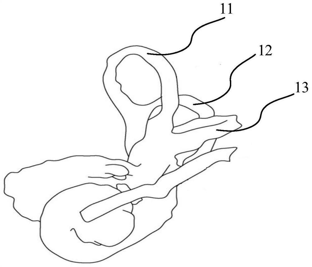 Spatial data processing and positioning method and device for temporal bone and electronic equipment