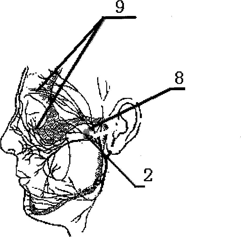 Embedded nerve electrode for recovering eyes-closed function and control system