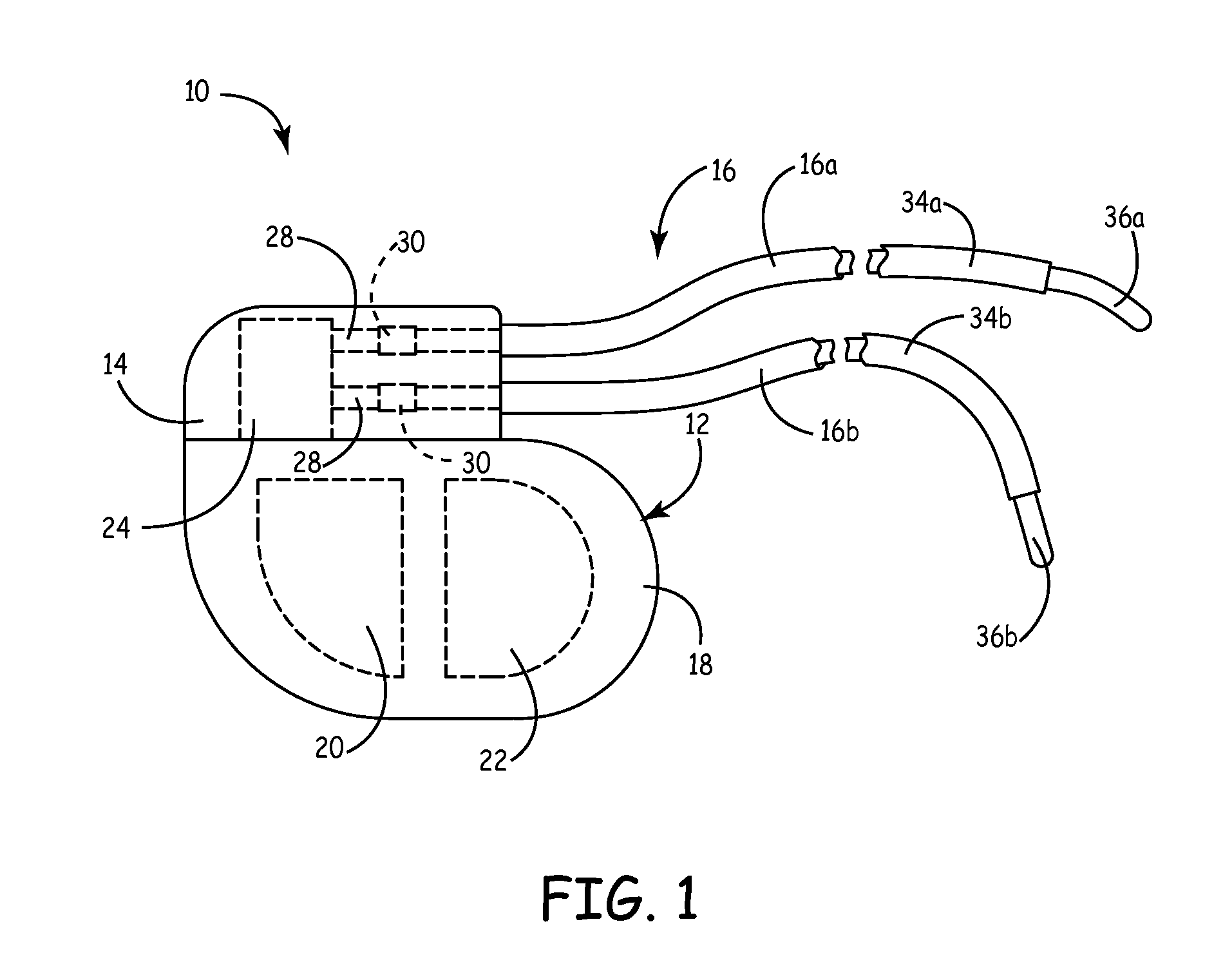 System and method for cardiac lead