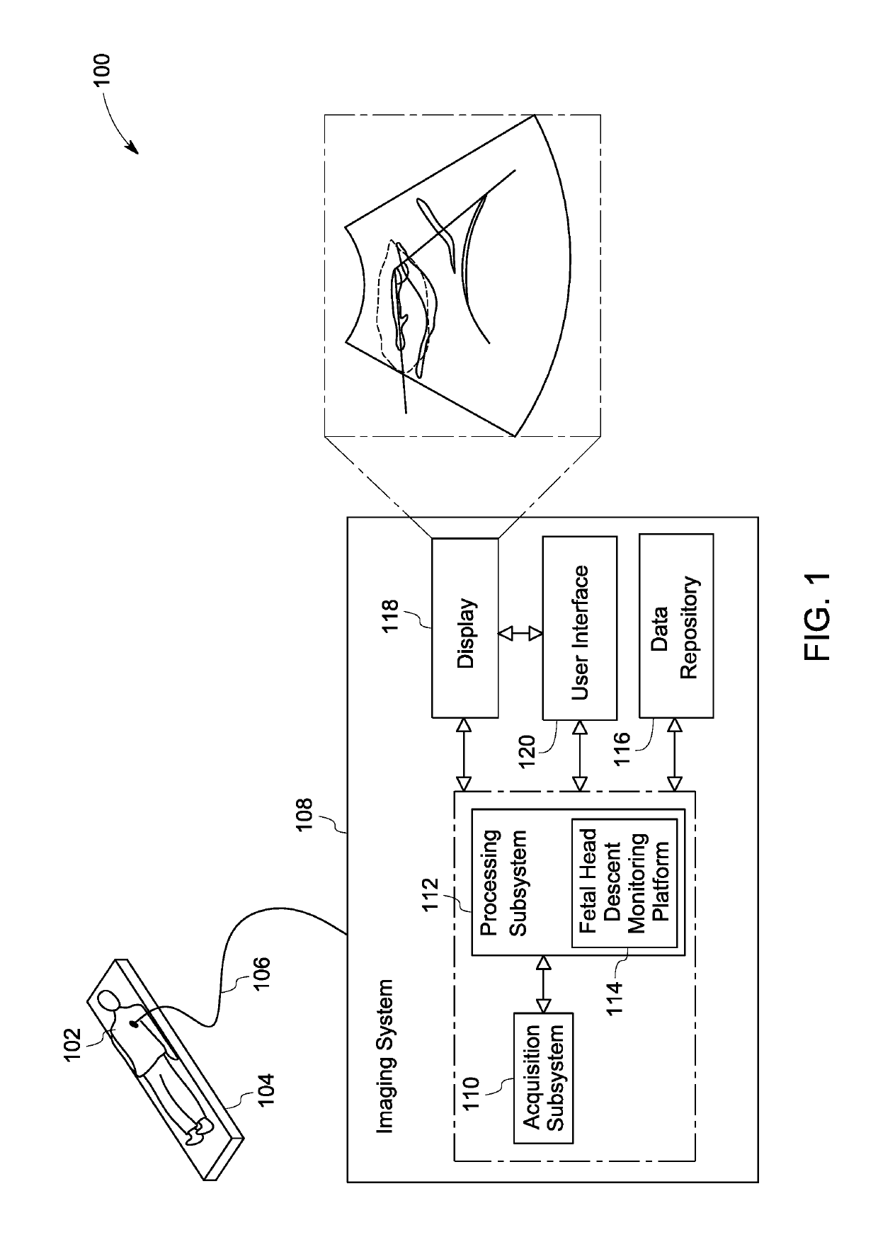 System and method for automated monitoring of fetal head descent during labor