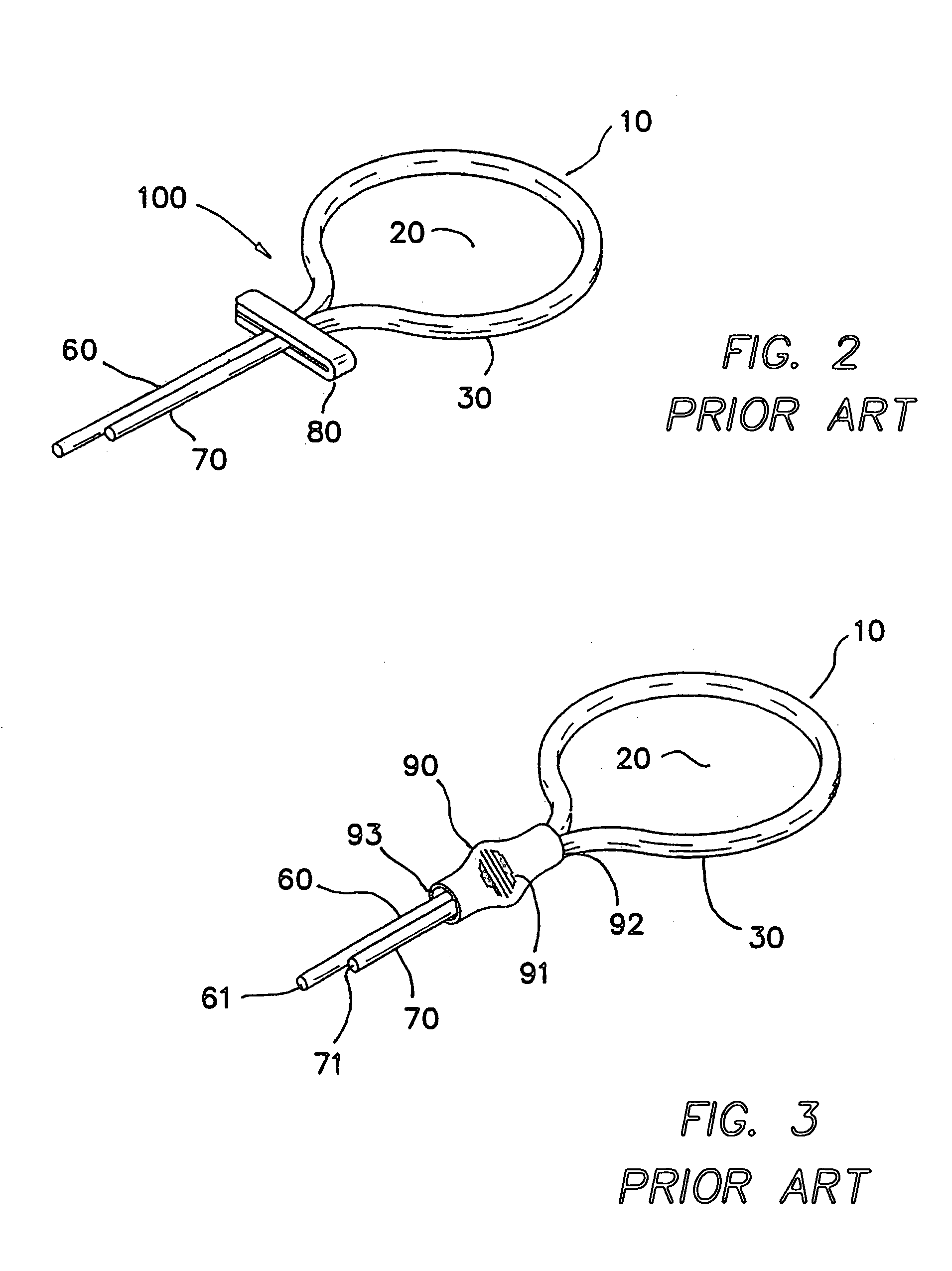 Suture securing device and method