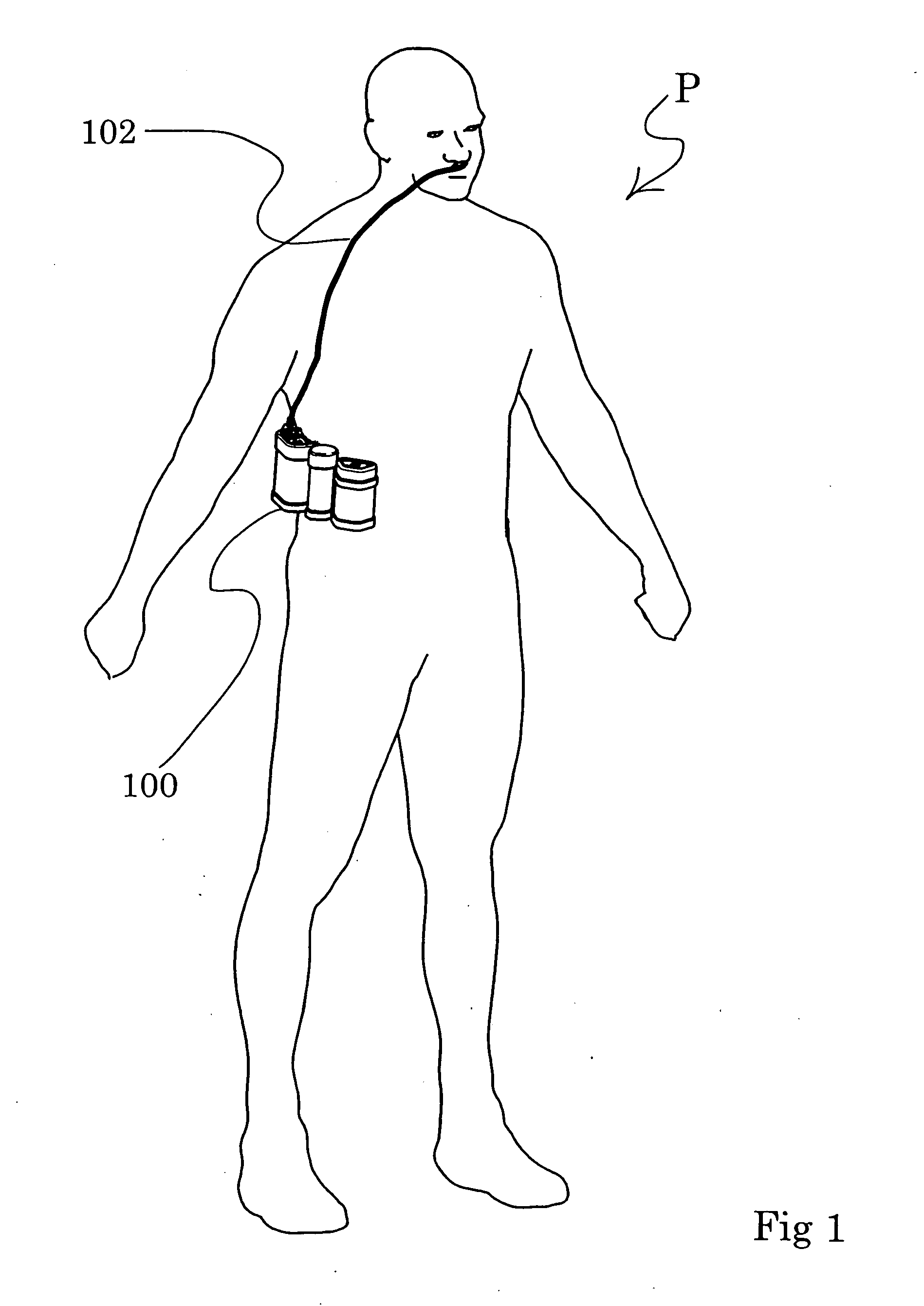 Portable oxygen concentrator with a docking station