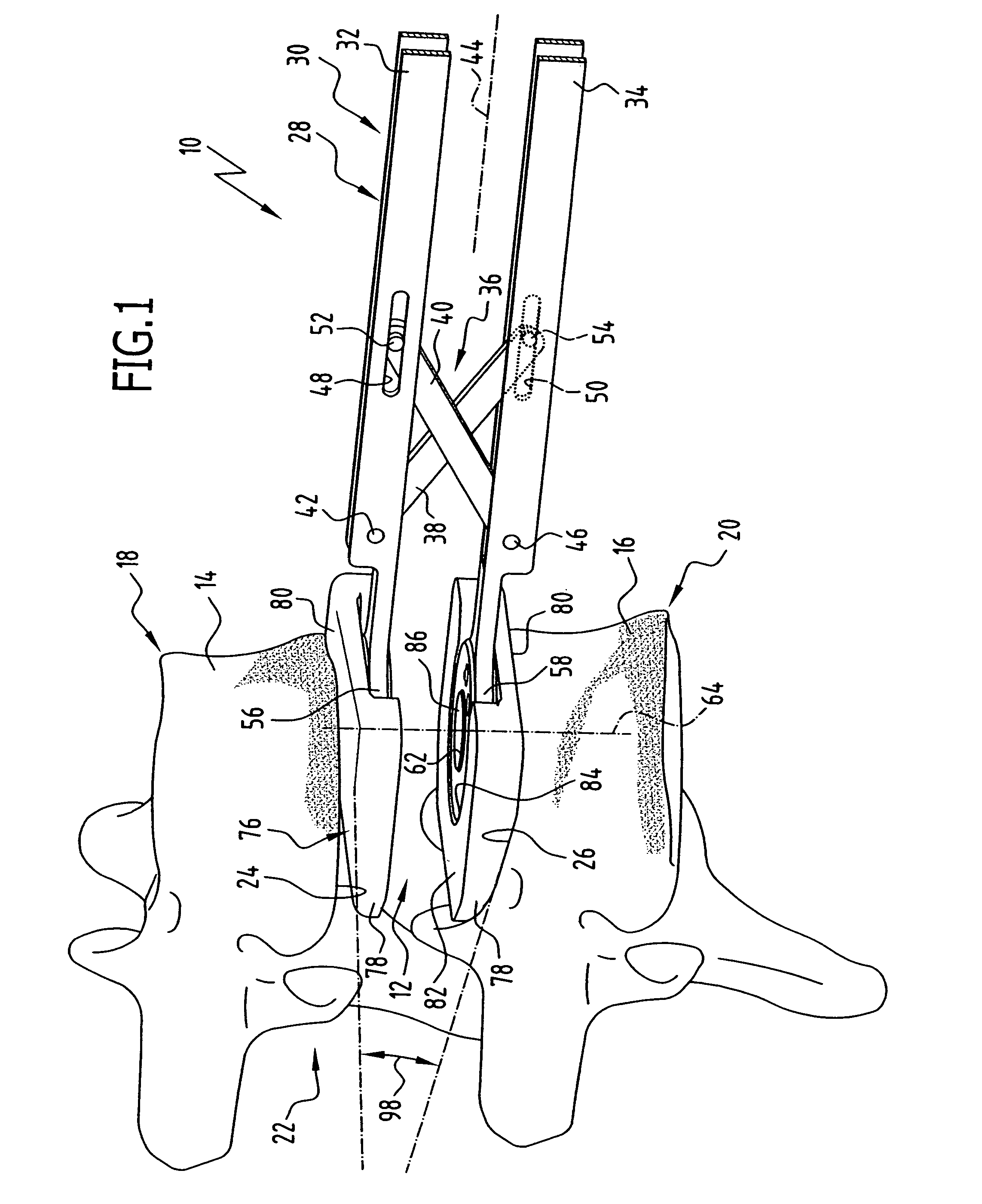 Surgical instrument for determining the size of intervertebral implant