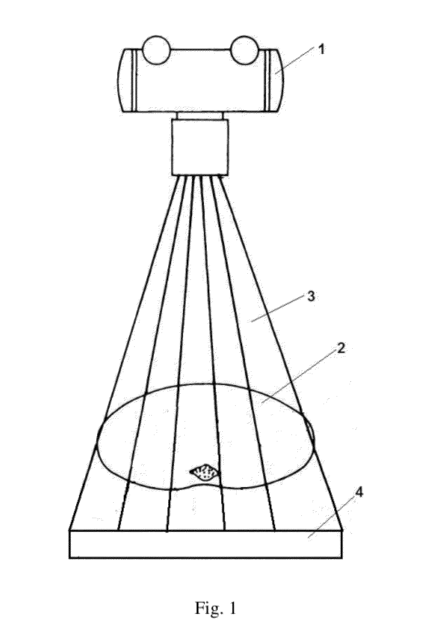 Noise Assessment Method for Digital X-ray Films