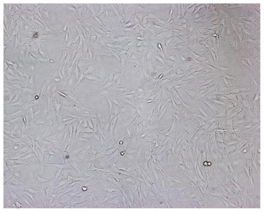 A wnt4/ywhaz co-modified mesenchymal stem cell-derived exosome and its preparation method and application