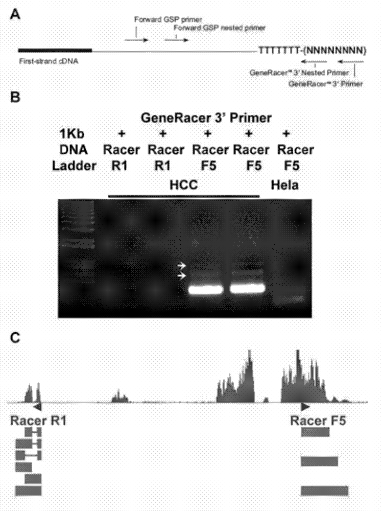 Application method of long-chain non-coding ribonucleic acid (RNA) gene in preparation of interference inhibitor