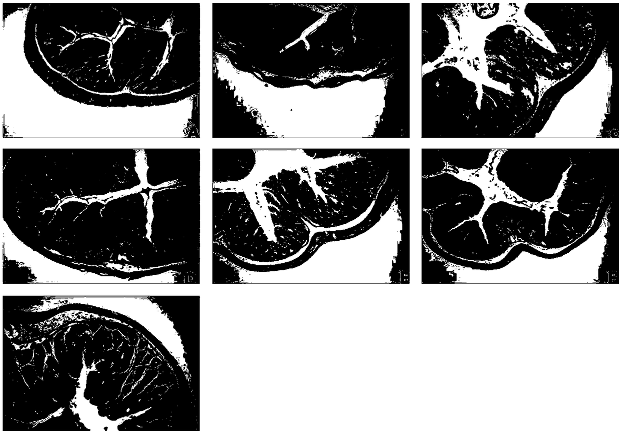 Anti-ulcerative colitis granule and preparation method