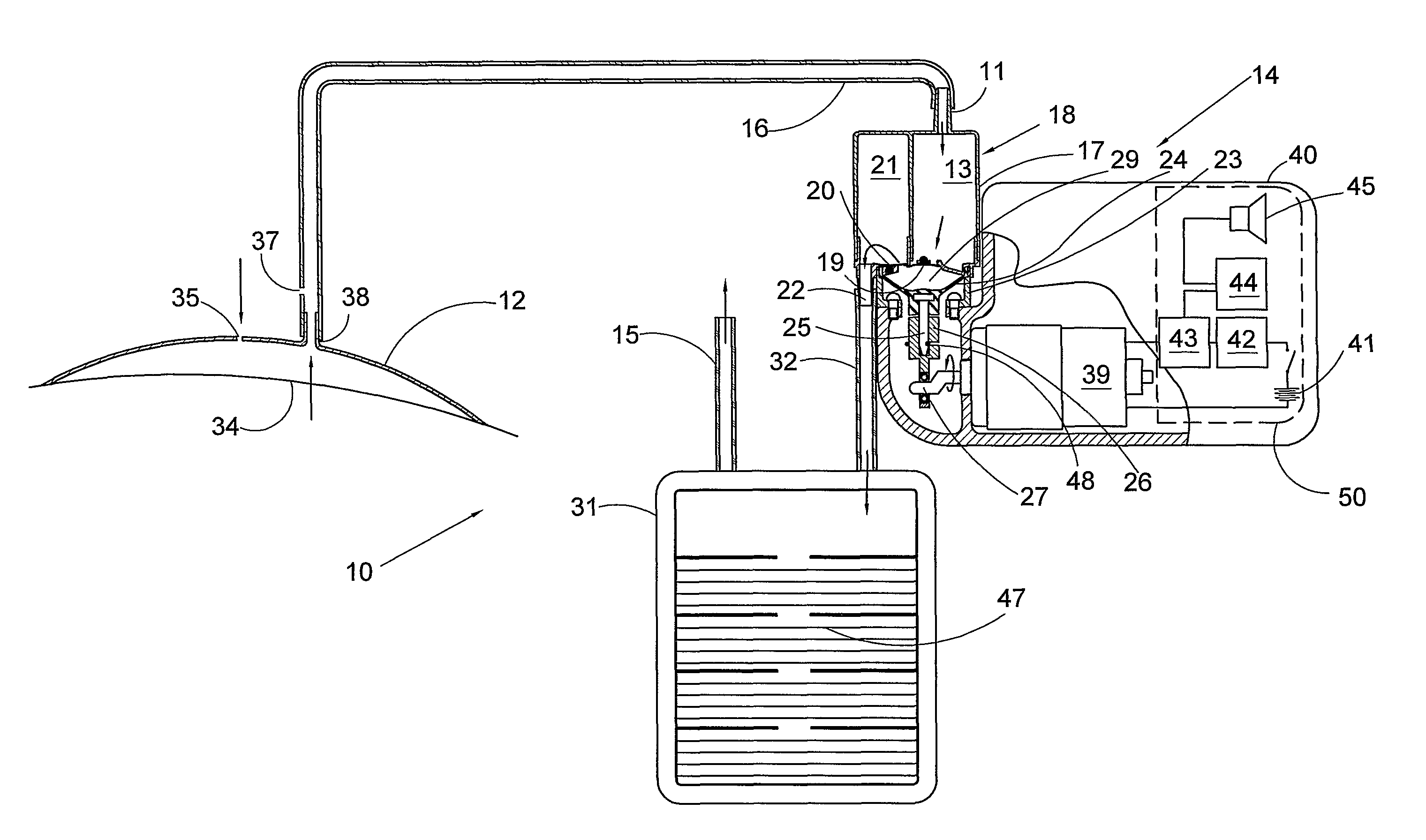 Wound closure and drainage system