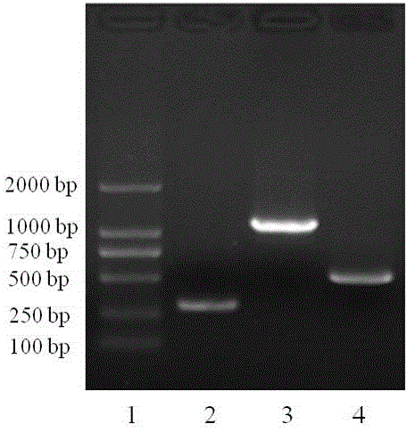 Construction and identification of Mycobacterium tuberculosis CFP10-38kD-19kD fusion protein