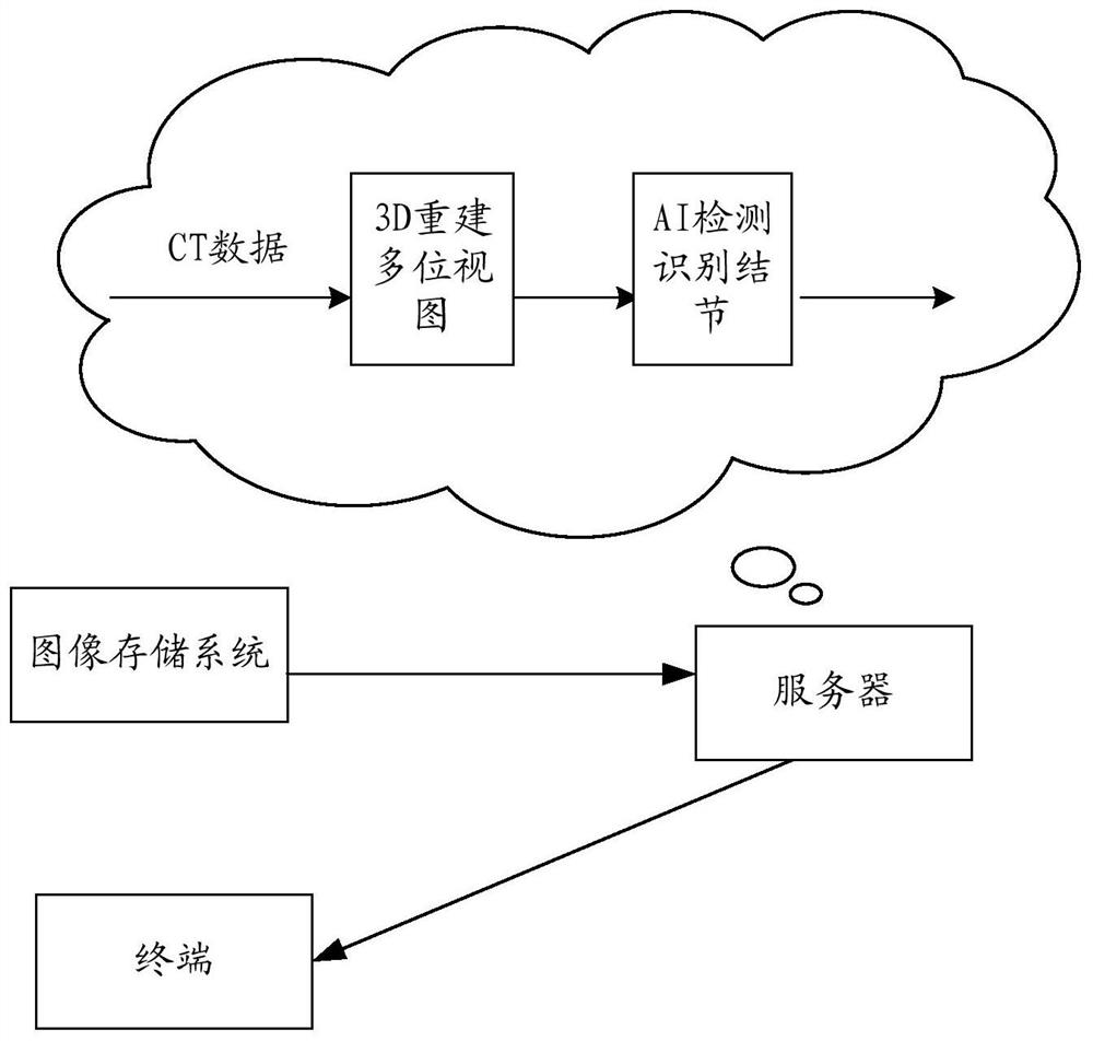 A nodule detection method, device and storage medium