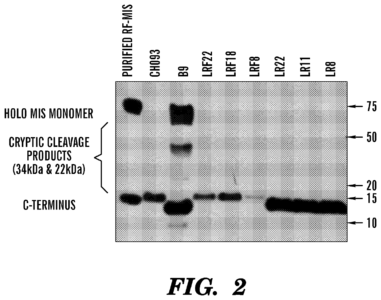 Modified Mullerian inhibiting substance (MIS) proteins and uses thereof for the treatment of diseases