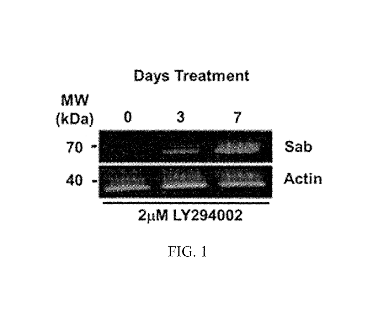 SAB as a biomarker for degenerative diseases and therapeutic sensitivity in cancers