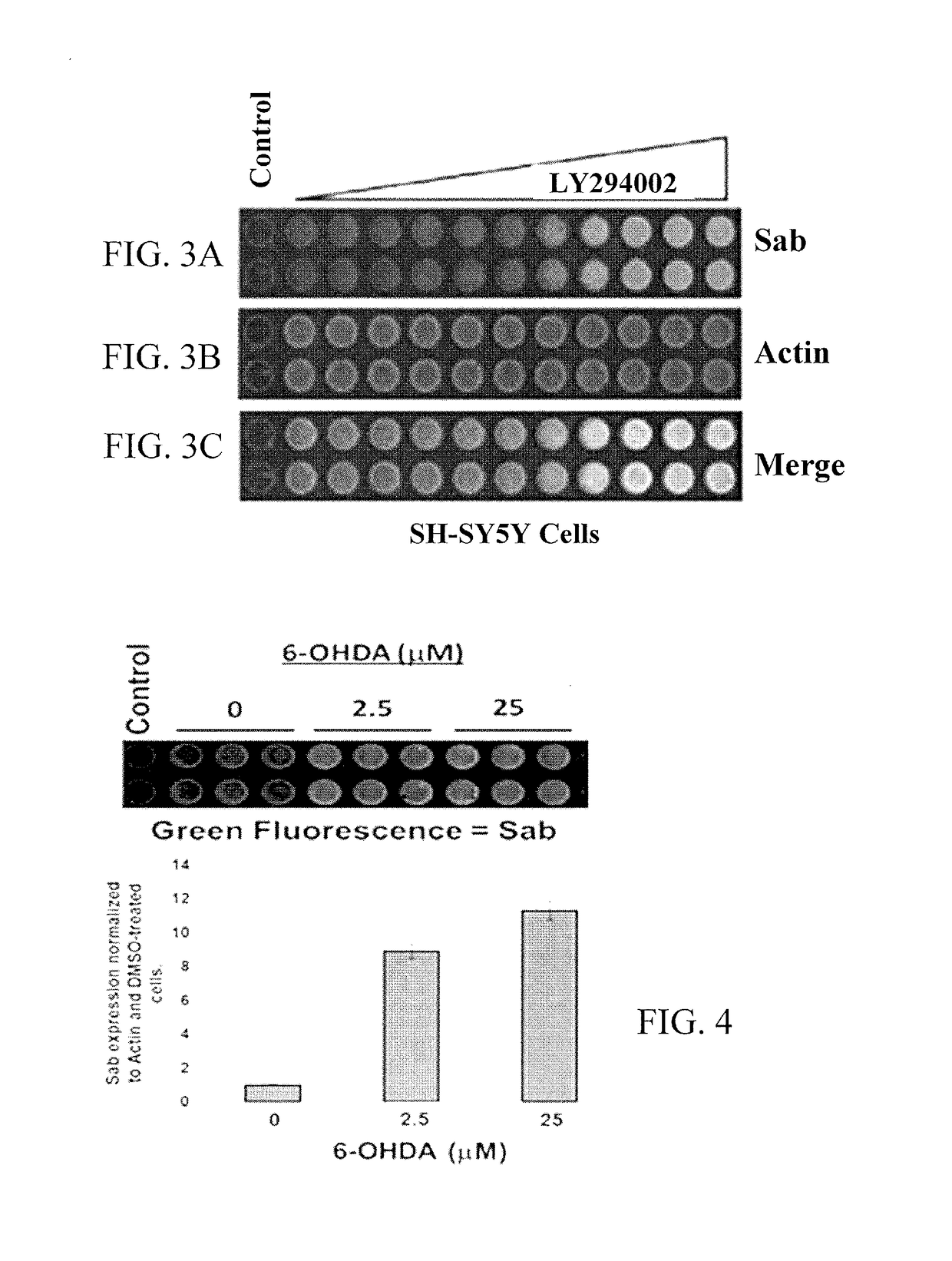 SAB as a biomarker for degenerative diseases and therapeutic sensitivity in cancers