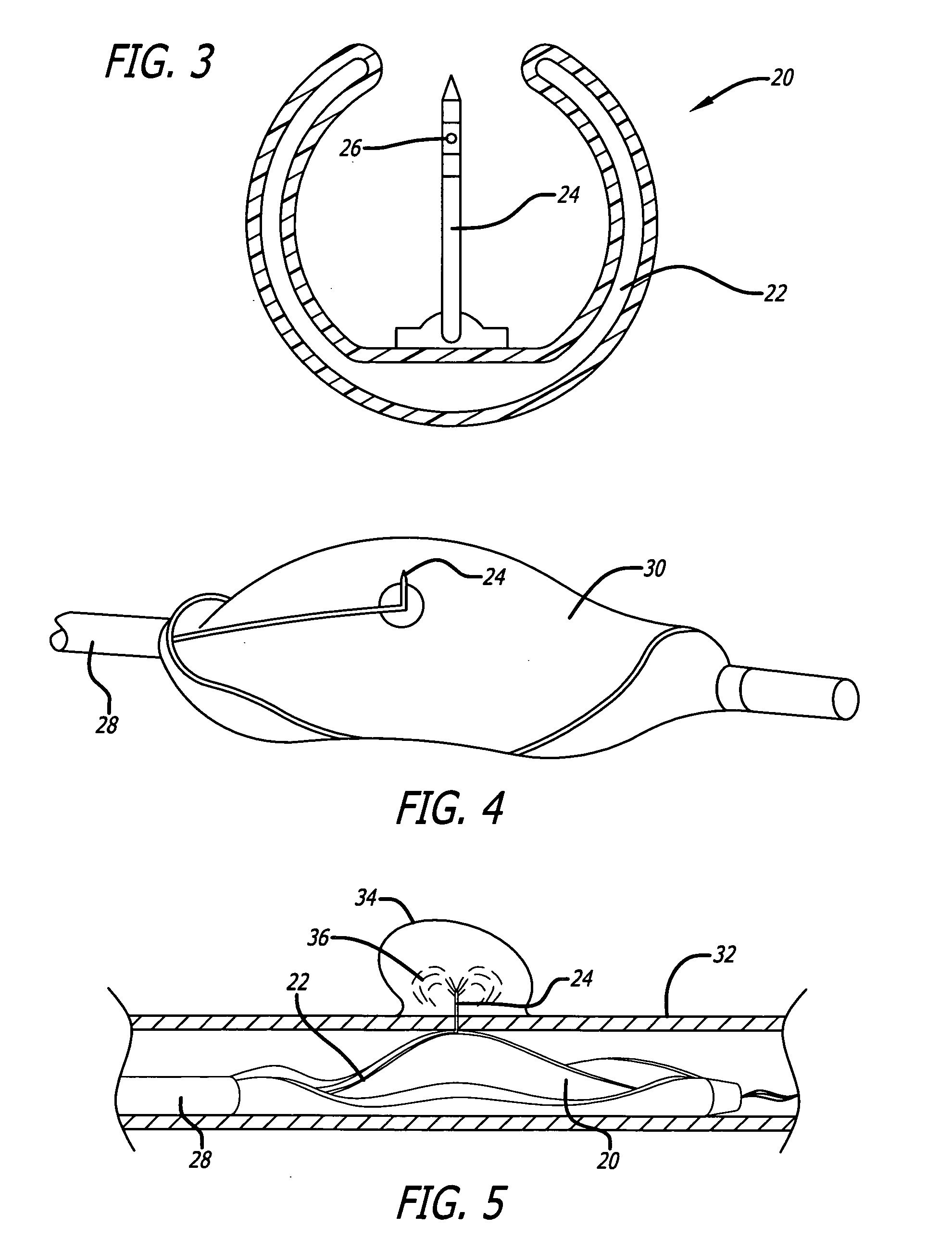 Medical devices and compositions useful for treating or inhibiting restenosis