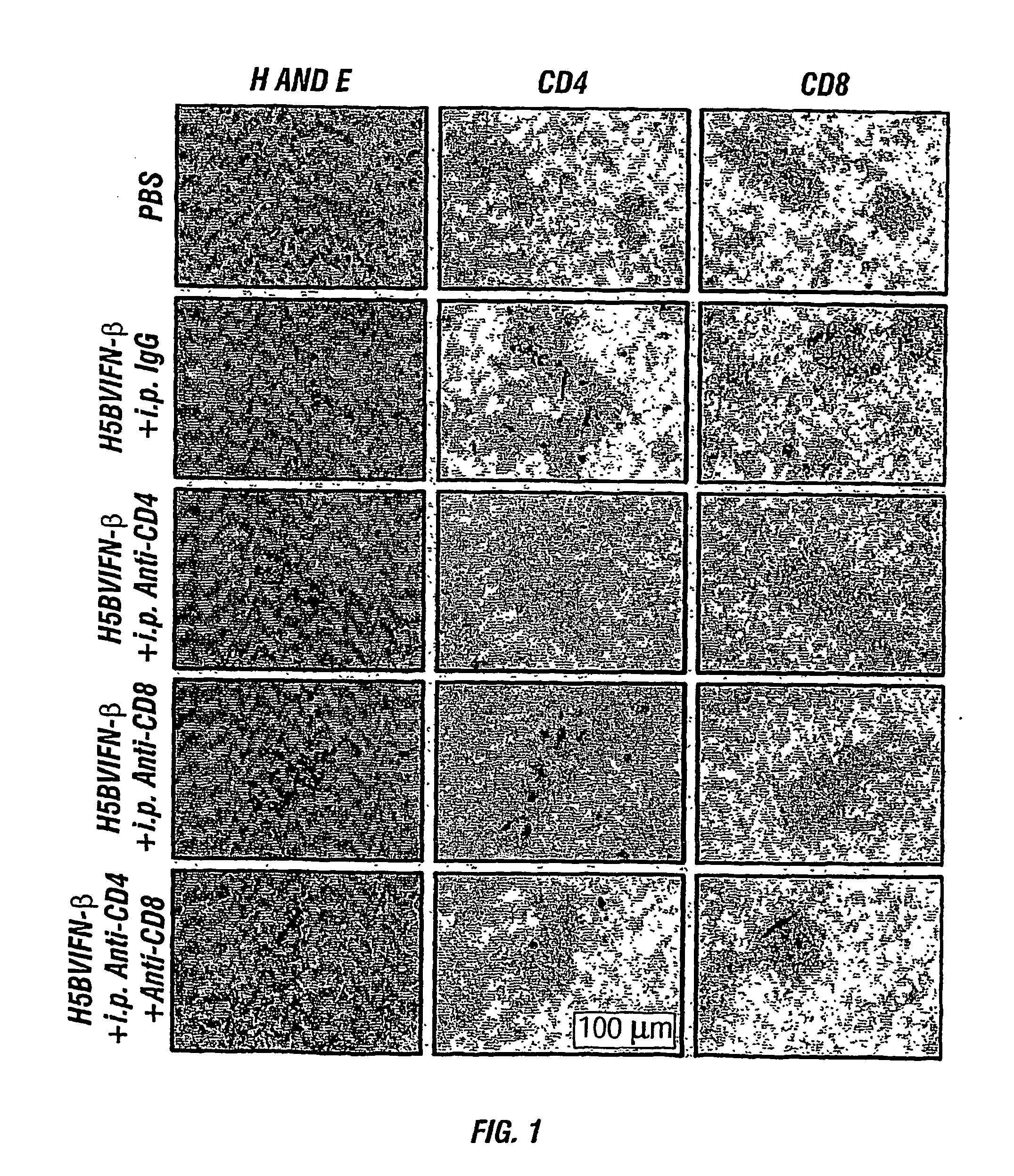 Active specific immunotherapy of cancer metastasis