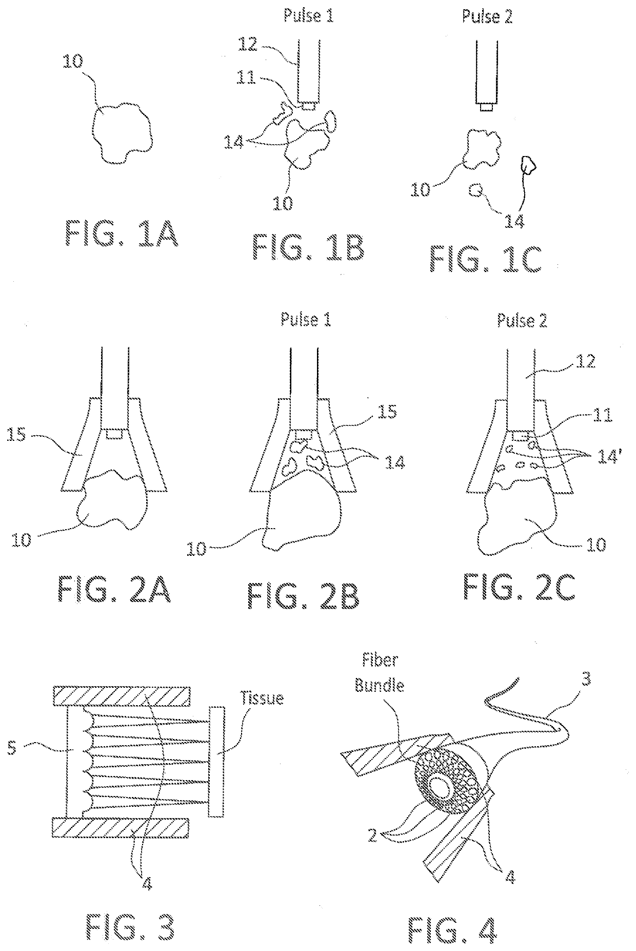 Method of reducing stone fragments to dust during laser lithotripsy