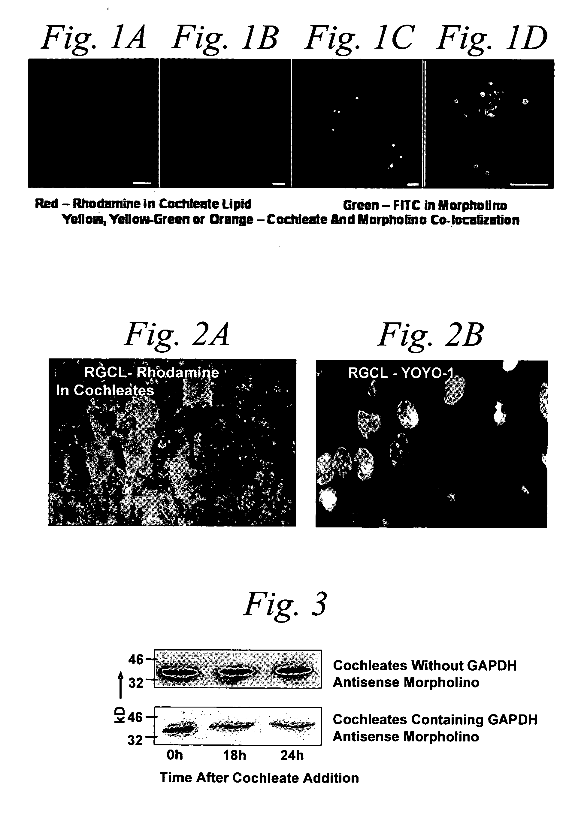 Cochleate compositions directed against expression of proteins