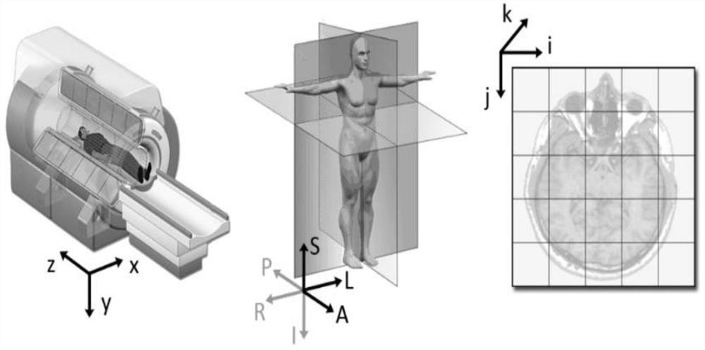 Method for automatically detecting and positioning posterior superior iliac spine based on CT (Computed Tomography) image