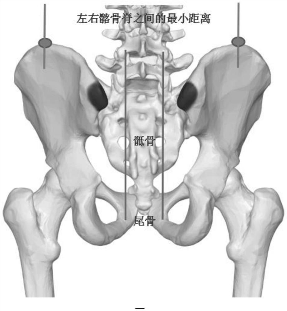 Method for automatically detecting and positioning posterior superior iliac spine based on CT (Computed Tomography) image