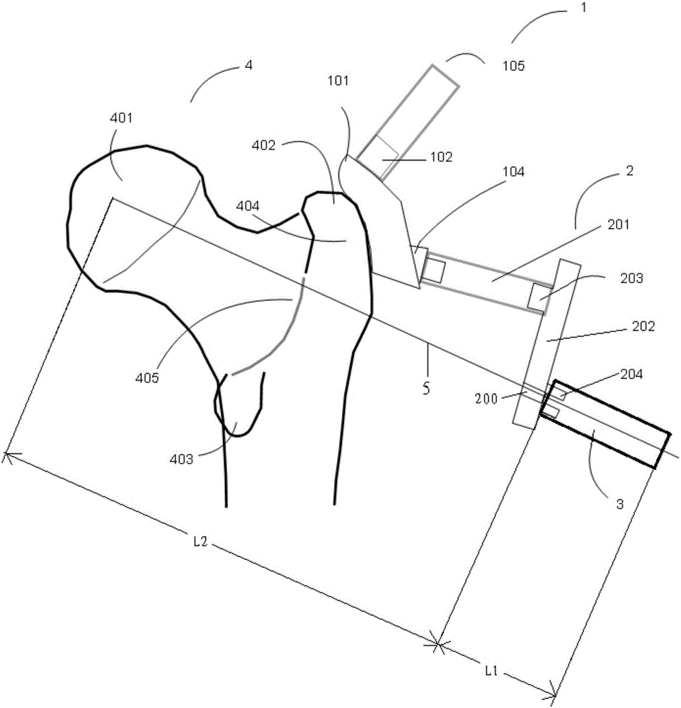 Proximal femur operation positioning and orientating system and manufacturing method thereof