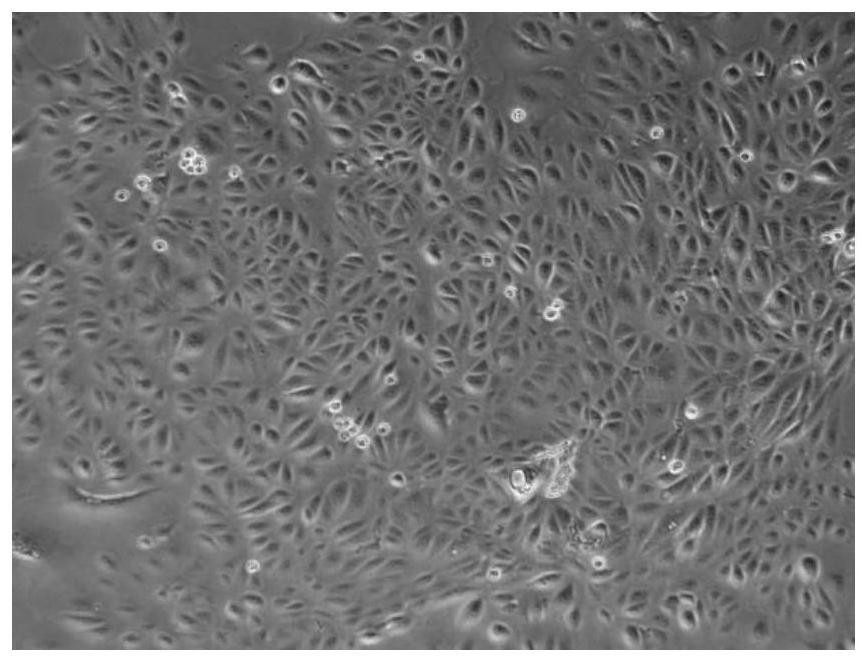 Pharmaceutical application of amniotic epithelial cell conditioned medium
