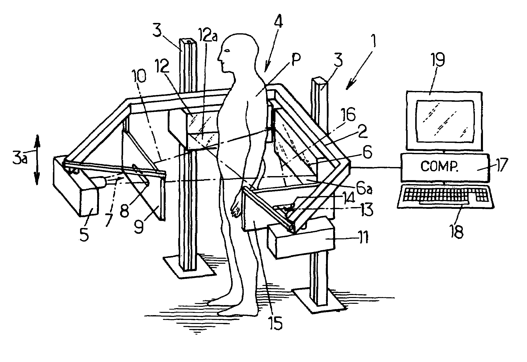 Method of radiographic imaging for three-dimensional reconstruction, and a computer program and apparatus for implementing the method