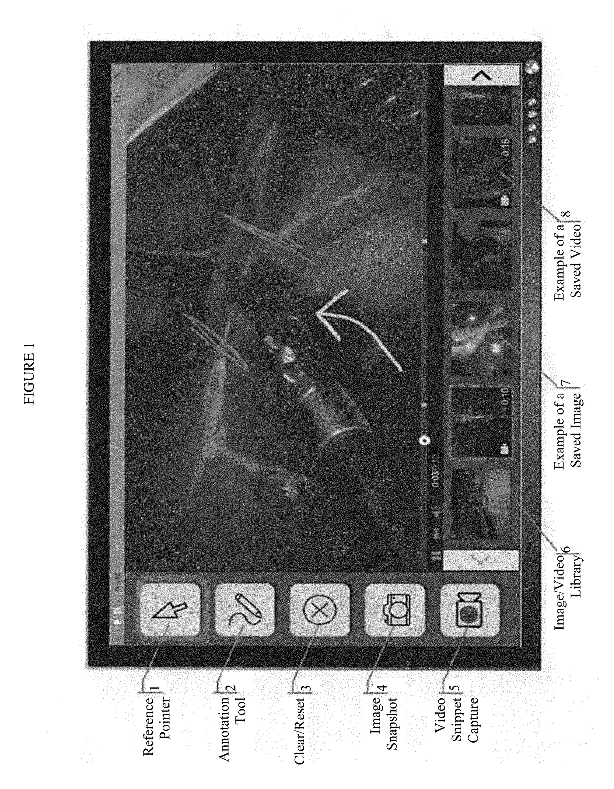 Annotation of endoscopic video using gesture and voice commands