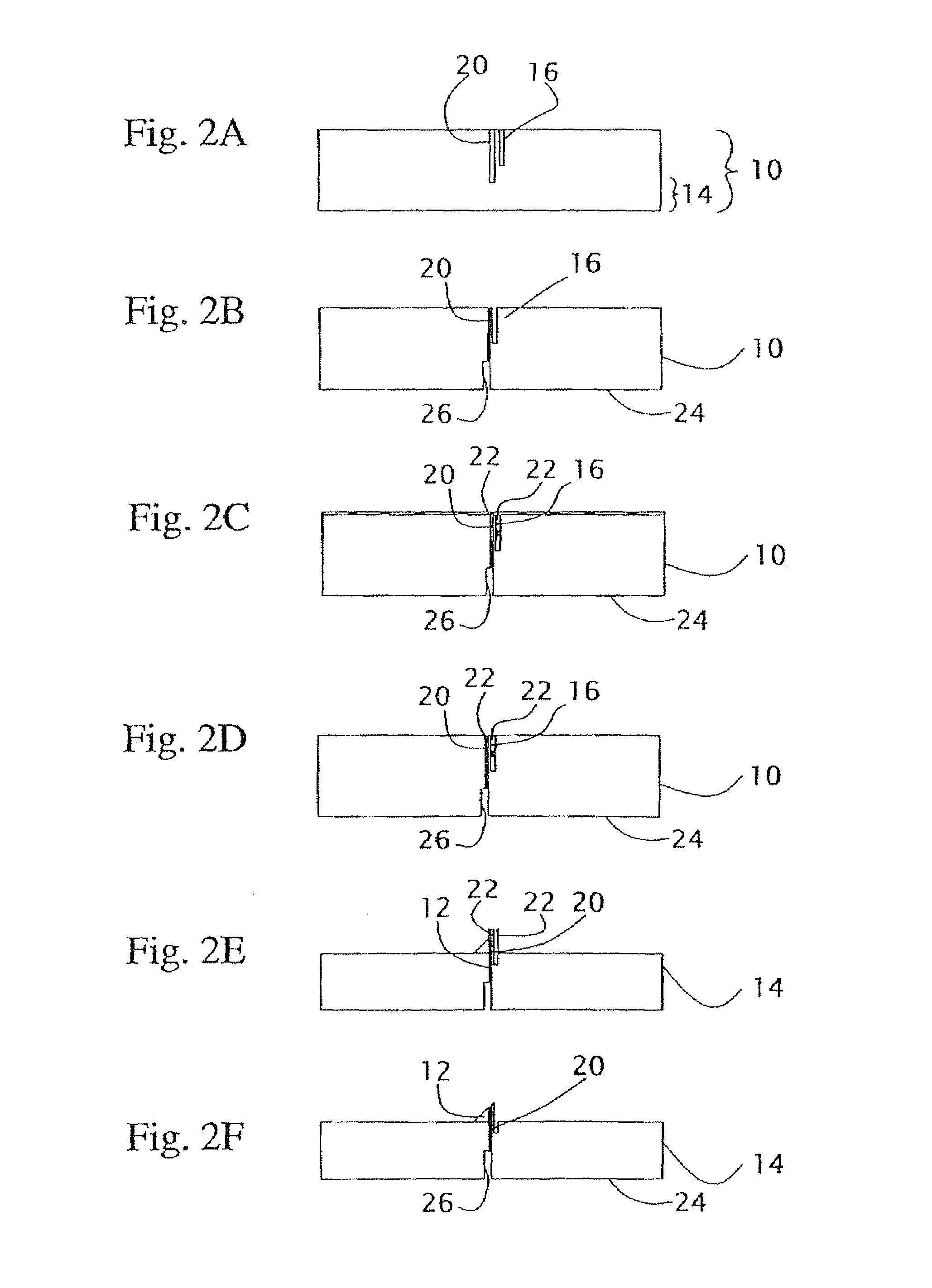 Microneedle structure and production method therefor