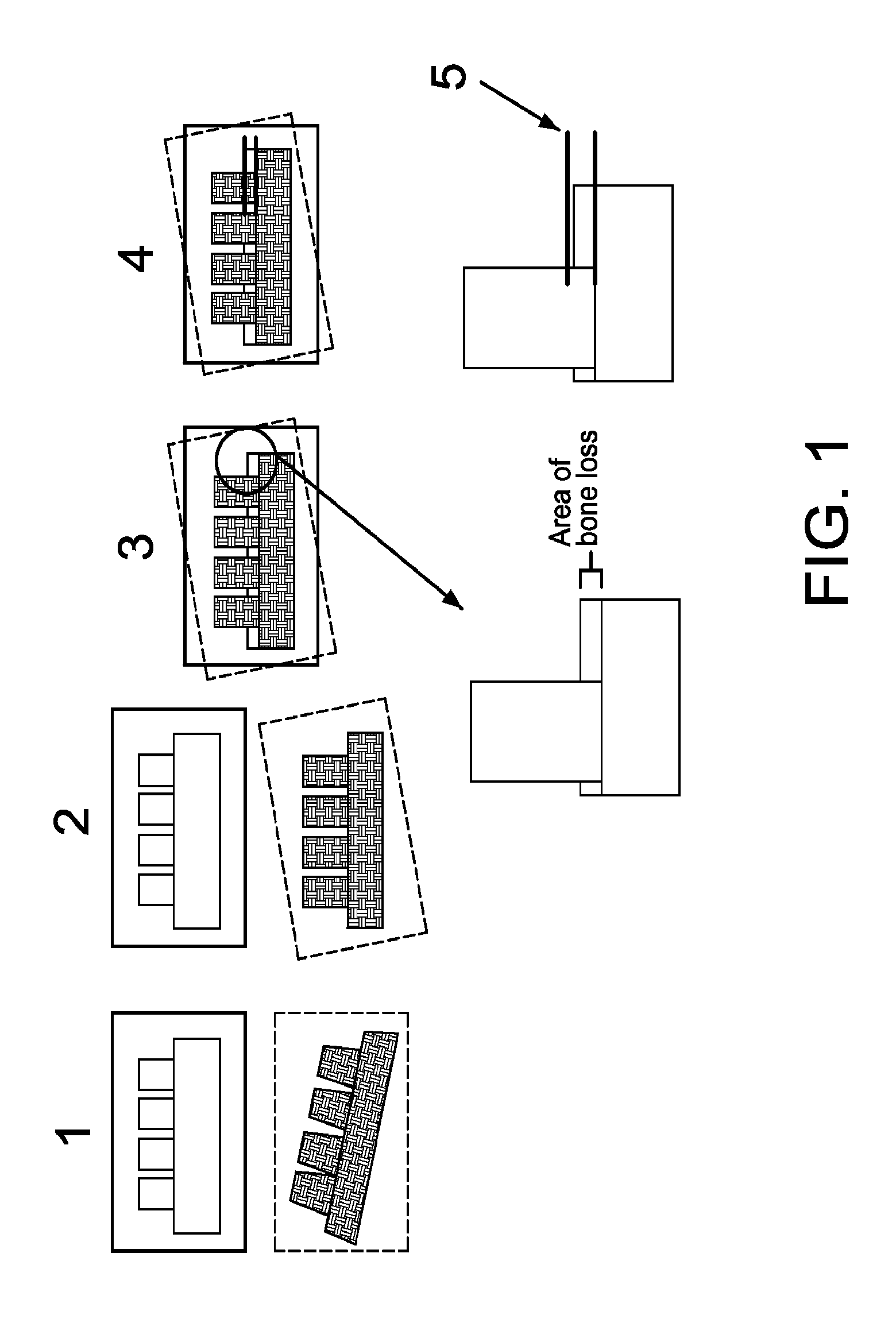 System and method for detecting and tracking change in dental X-rays and dental images