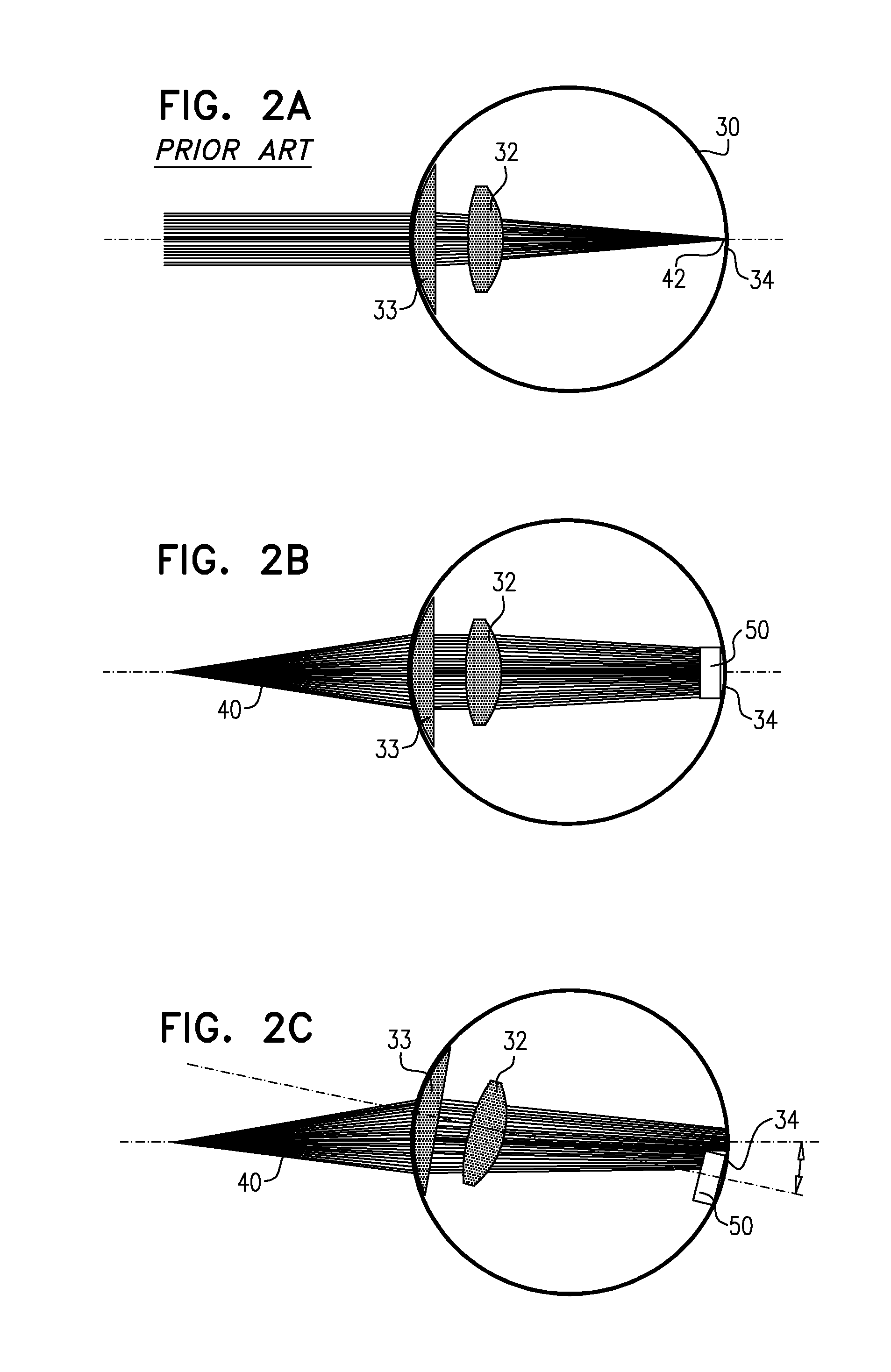Wearable apparatus for delivery of power to a retinal prosthesis