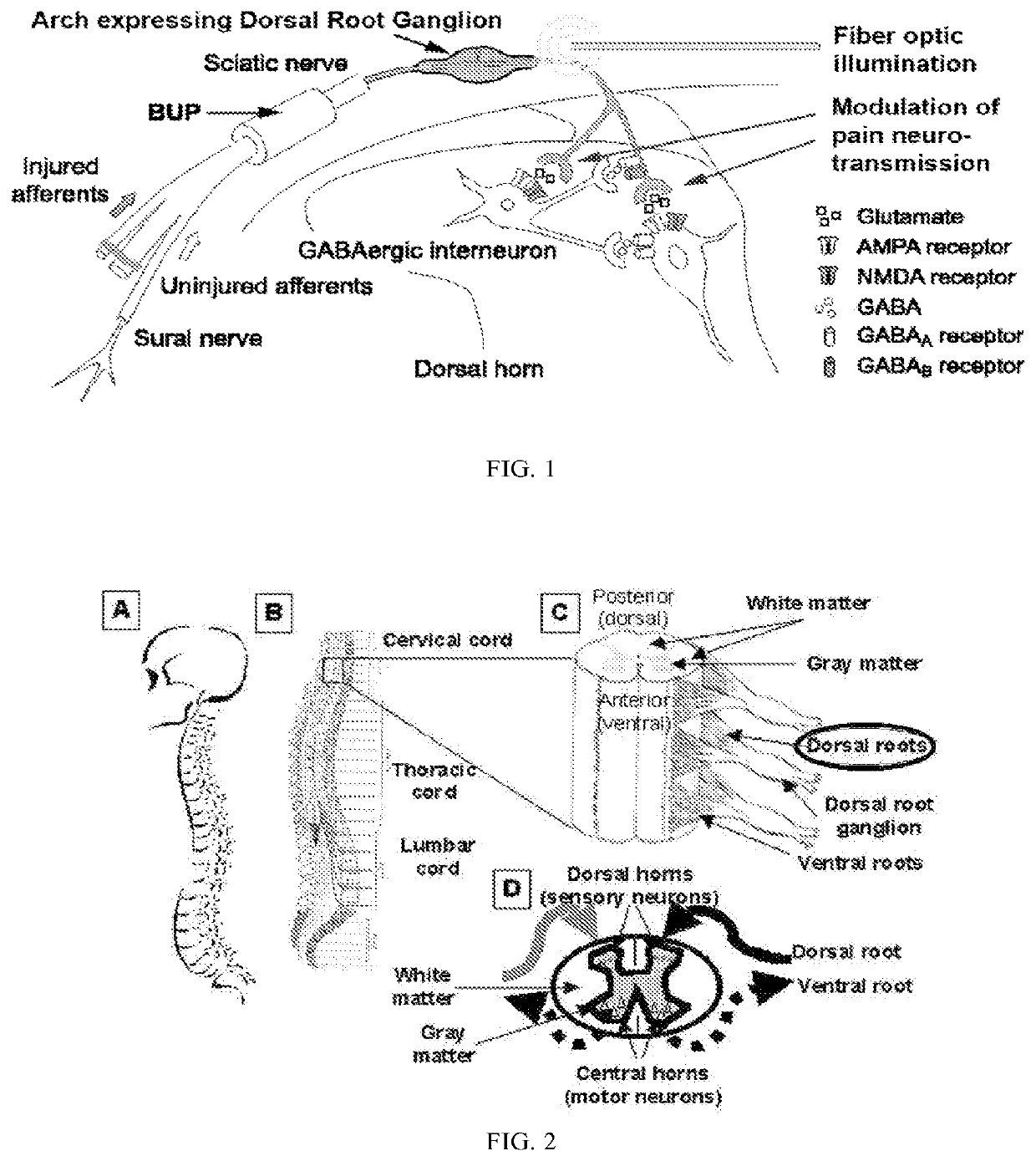 Methods and compositions for decreasing chronic pain