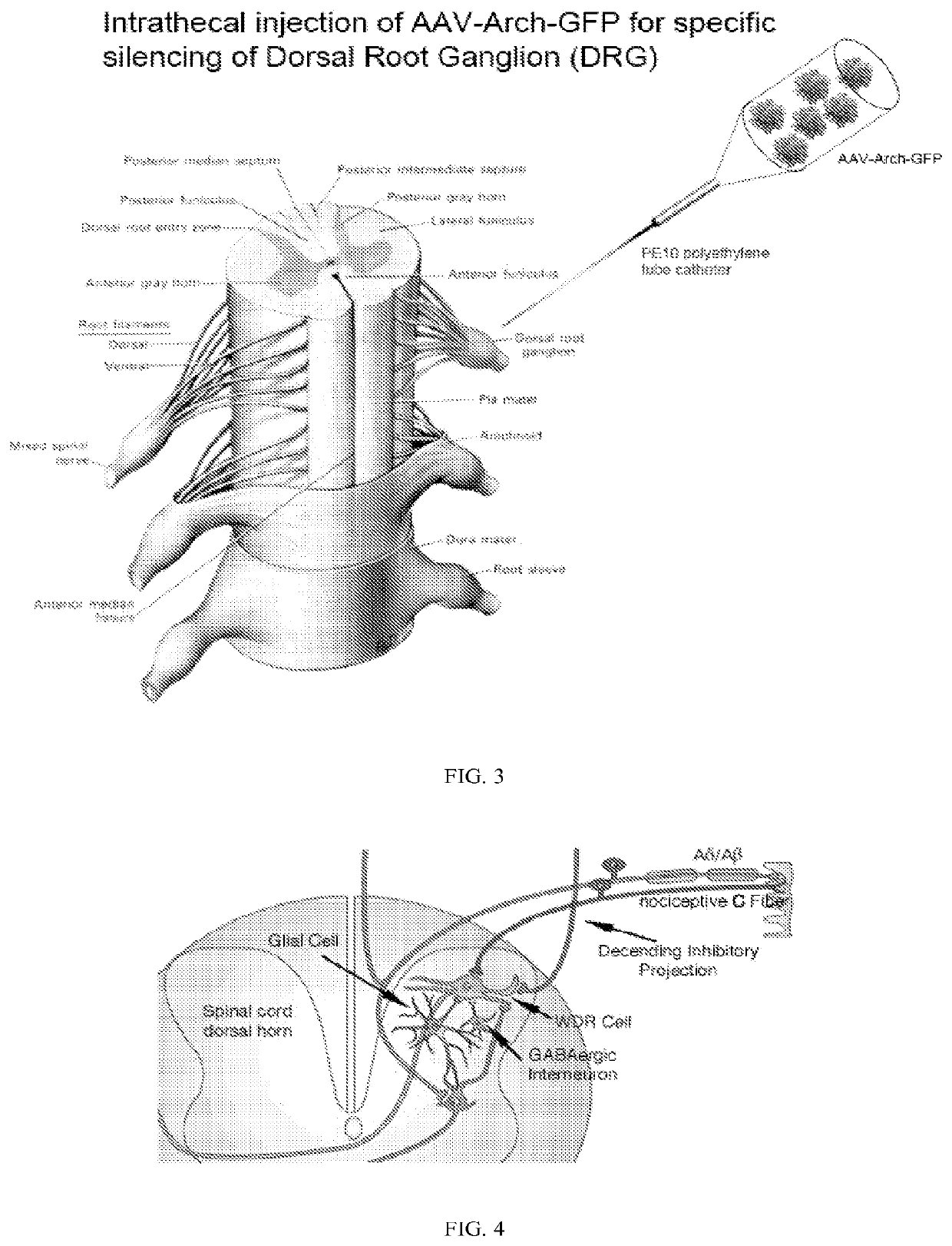 Methods and compositions for decreasing chronic pain