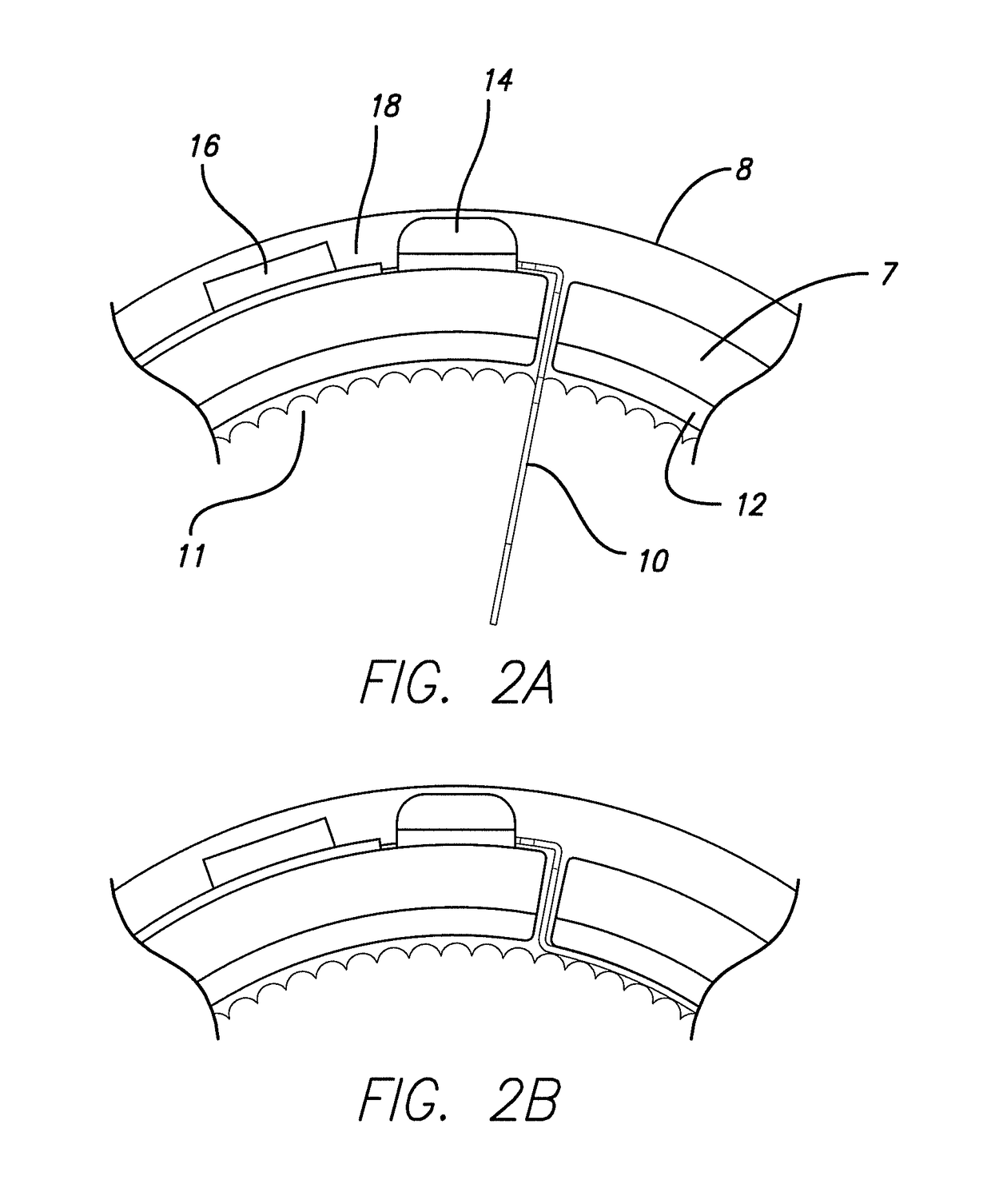 Cortical implant system for brain stimulation and recording