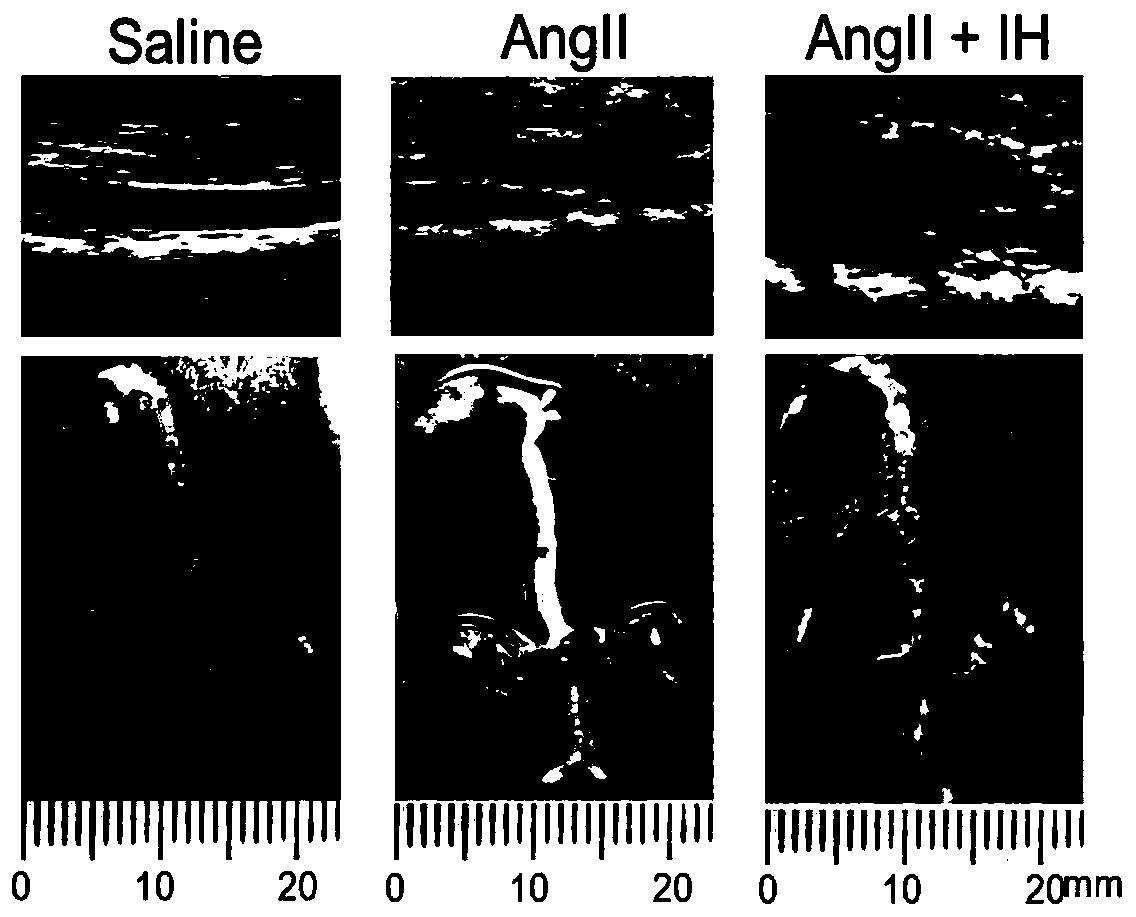 Construction method of obstructive sleep apnea and aortic dissection mouse model