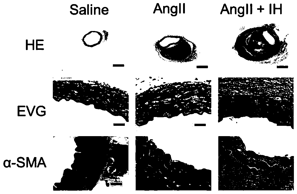 Construction method of obstructive sleep apnea and aortic dissection mouse model