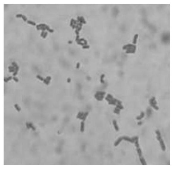 Bifidobacterium lactis and purpose thereof in acceleration of growth and development of children and adolescents