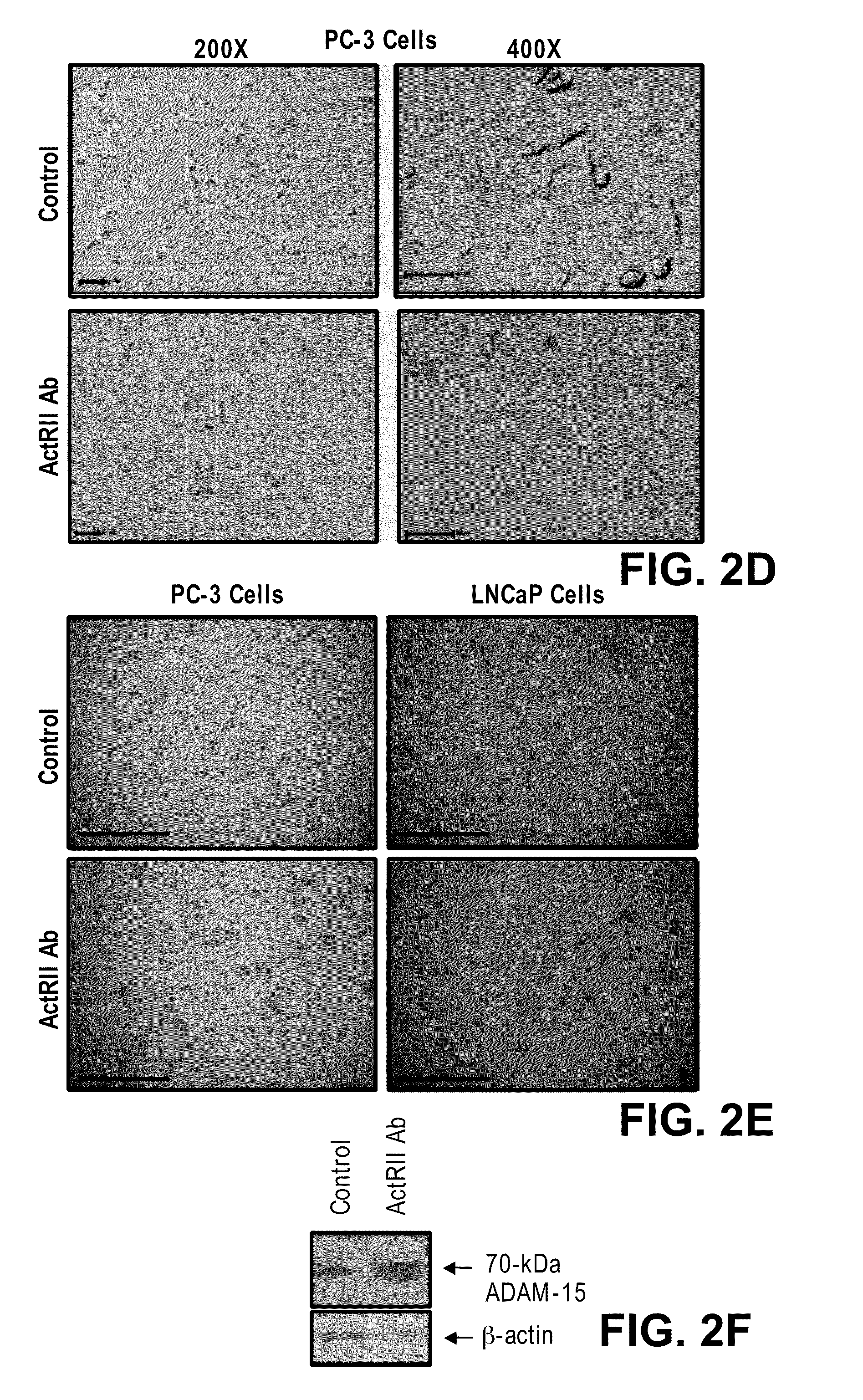 Methods for Identifying Agents that Inhibit Cell Migration, Promote Cell Adhesion and Prevent Metastasis