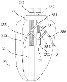 Heart valve adjustable auxiliary device and system